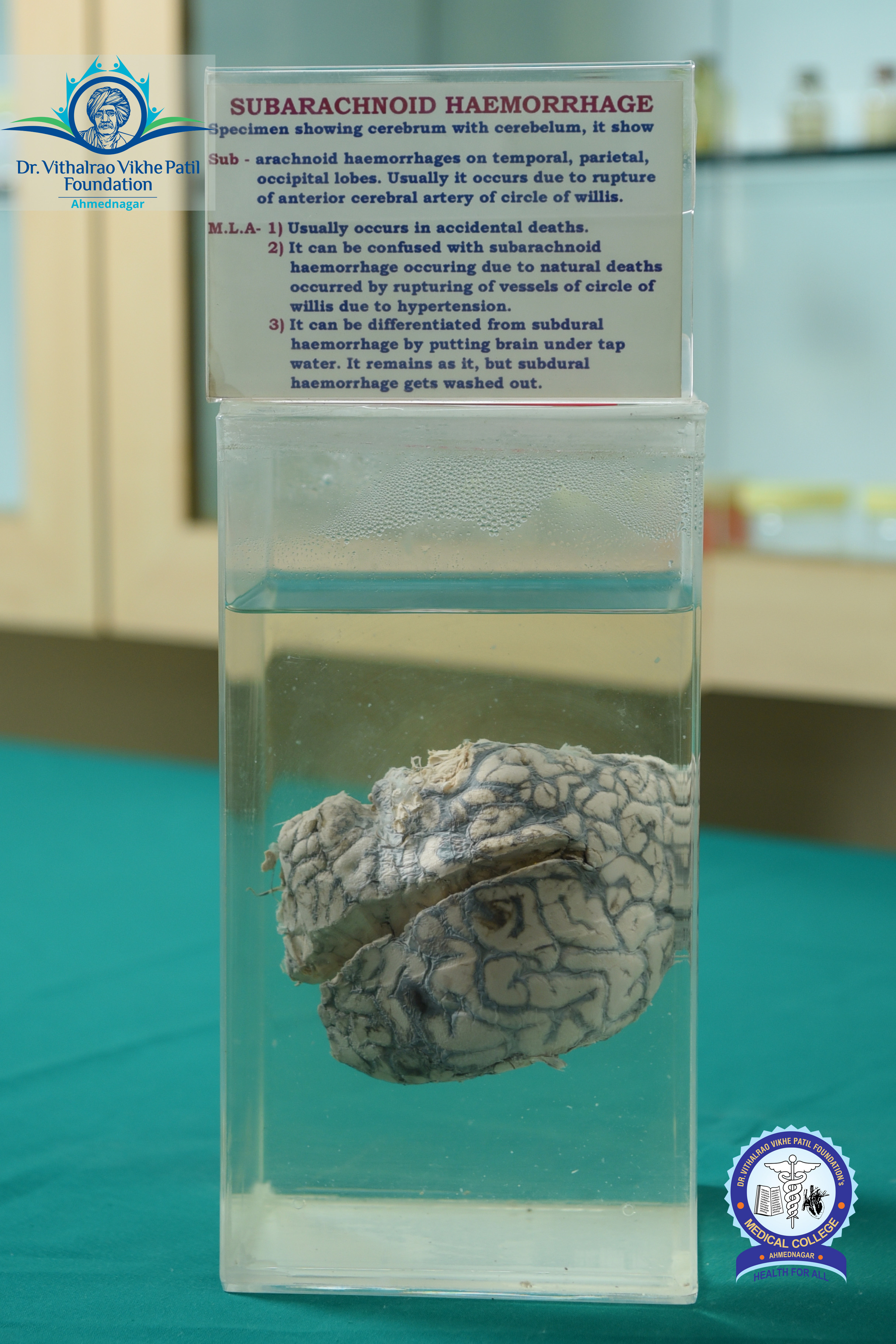 Popup Image