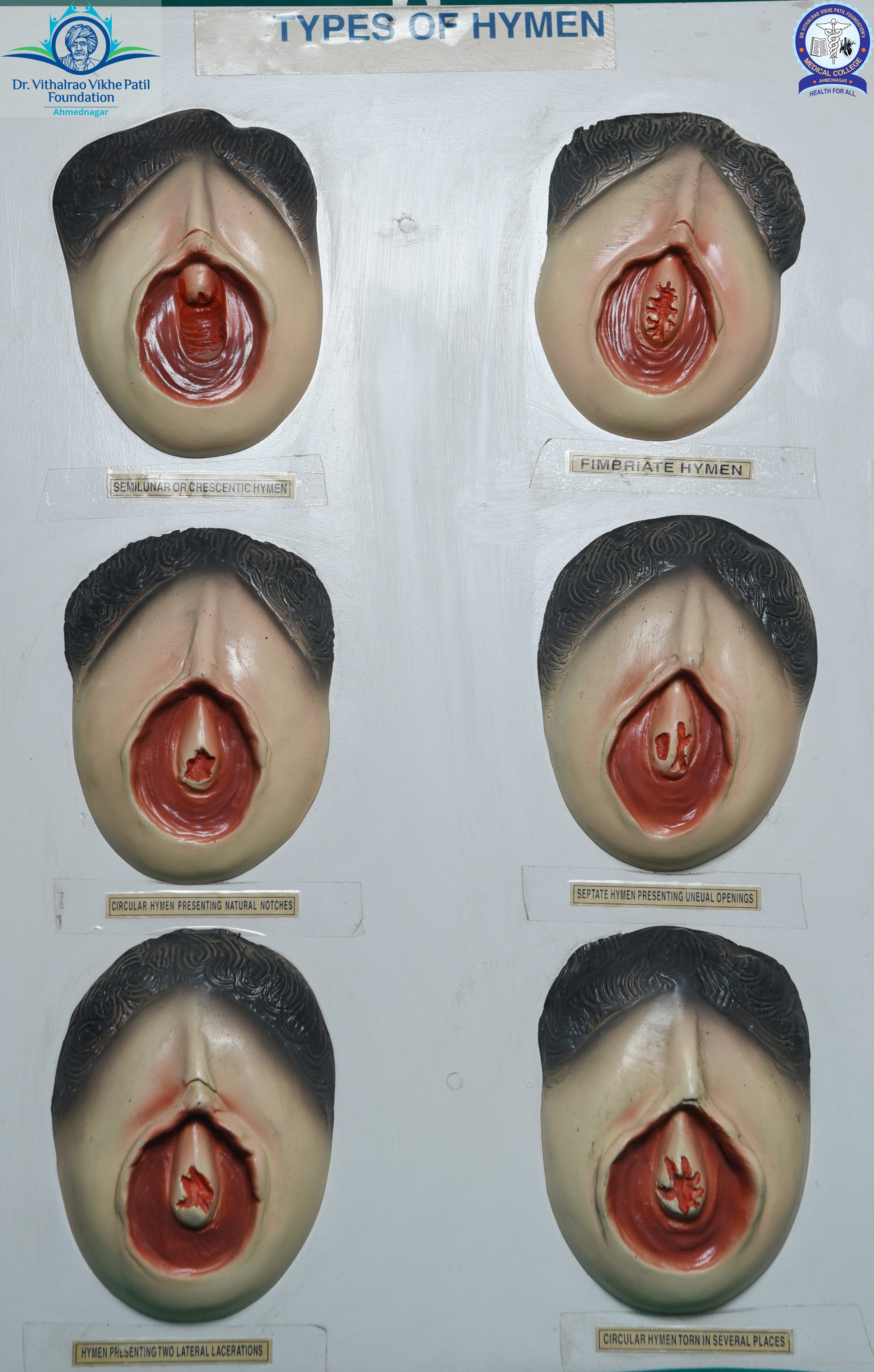 Popup Image