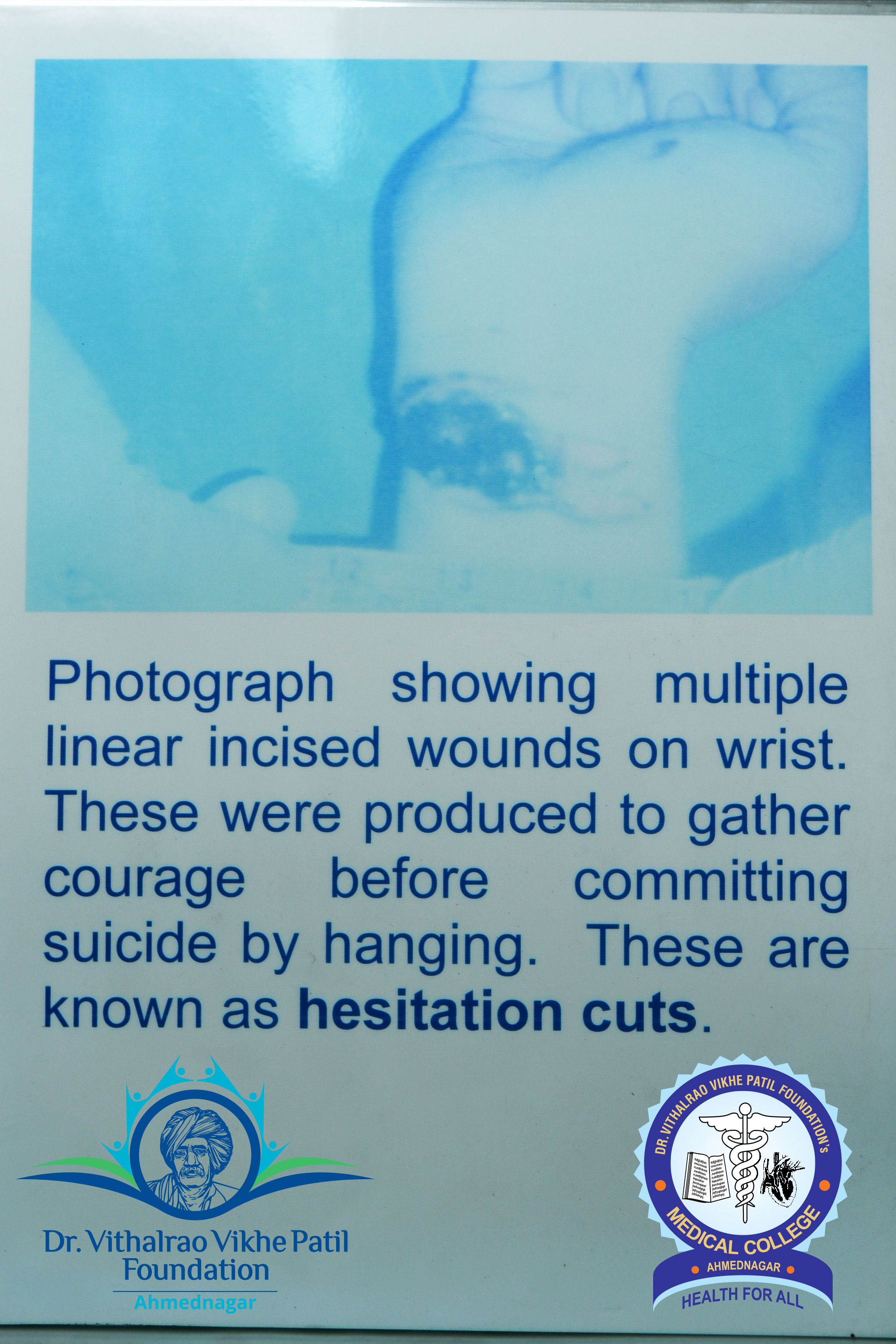Popup Image