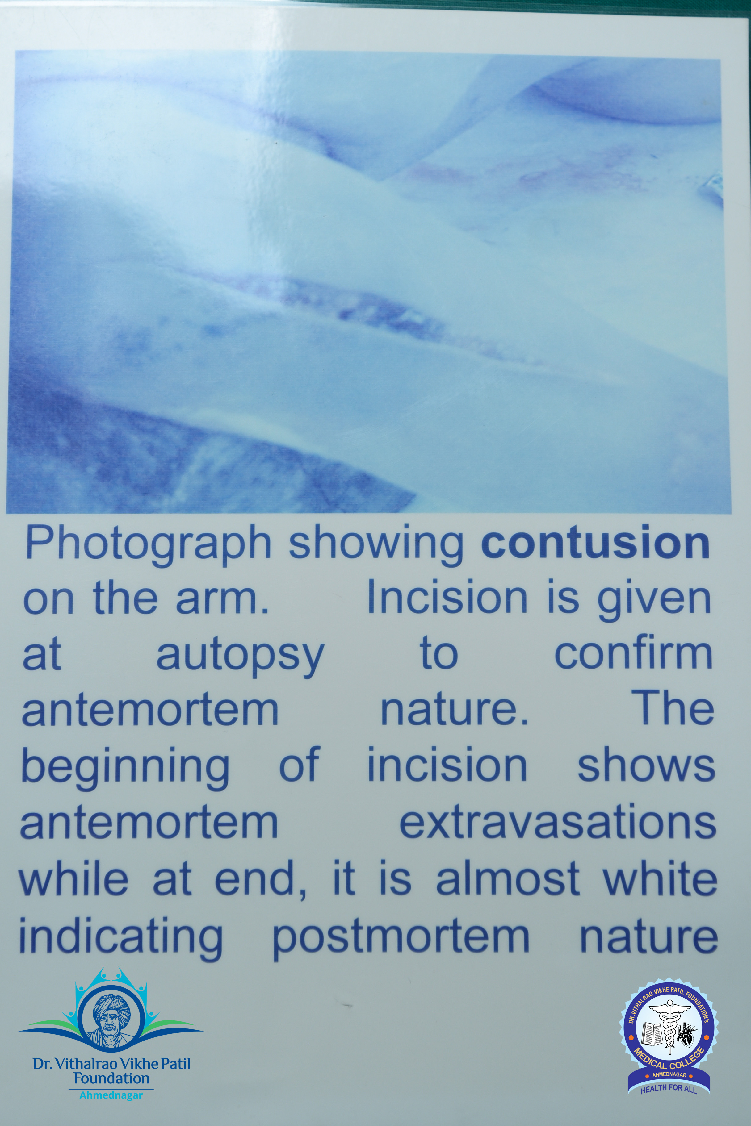 Popup Image