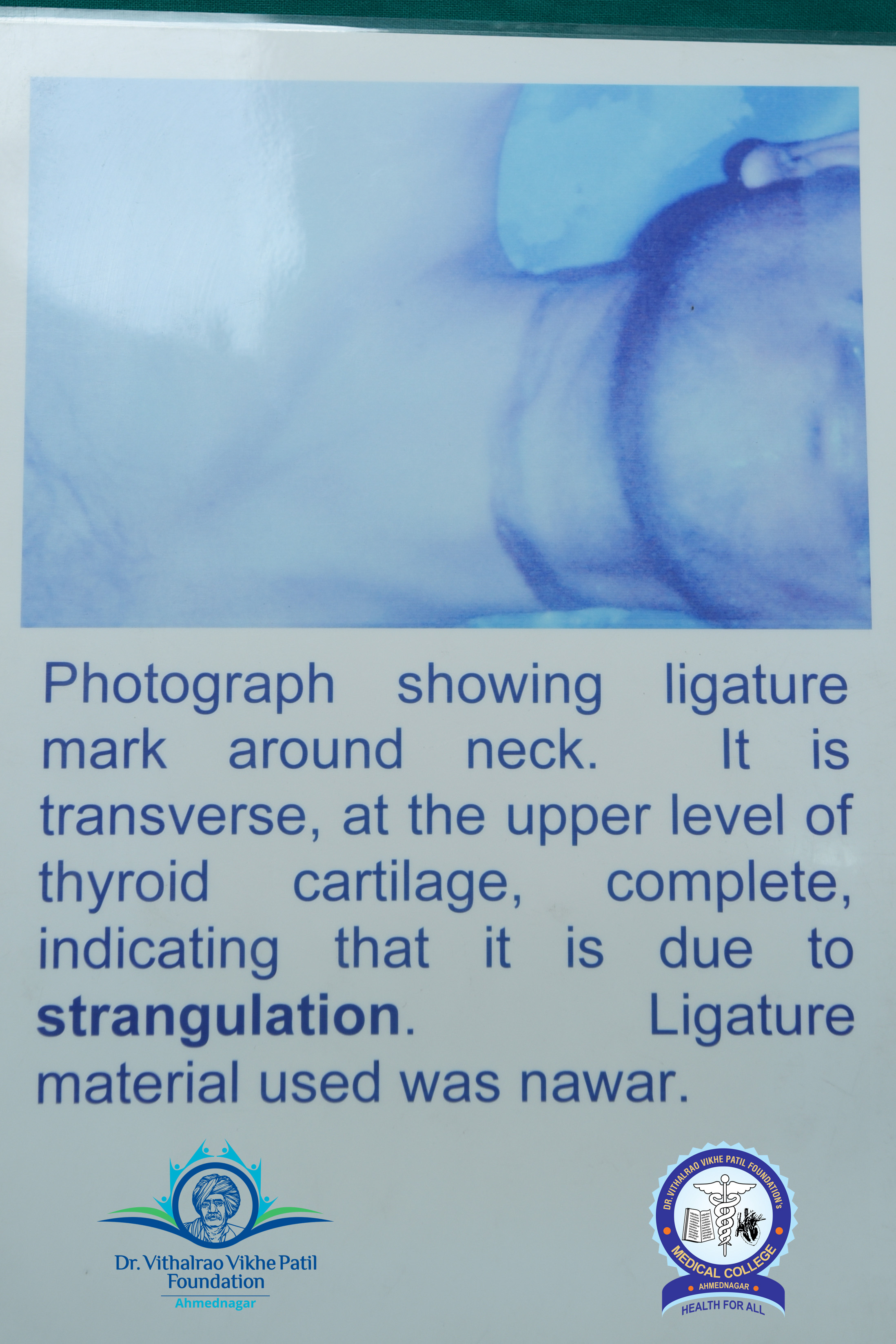 Popup Image