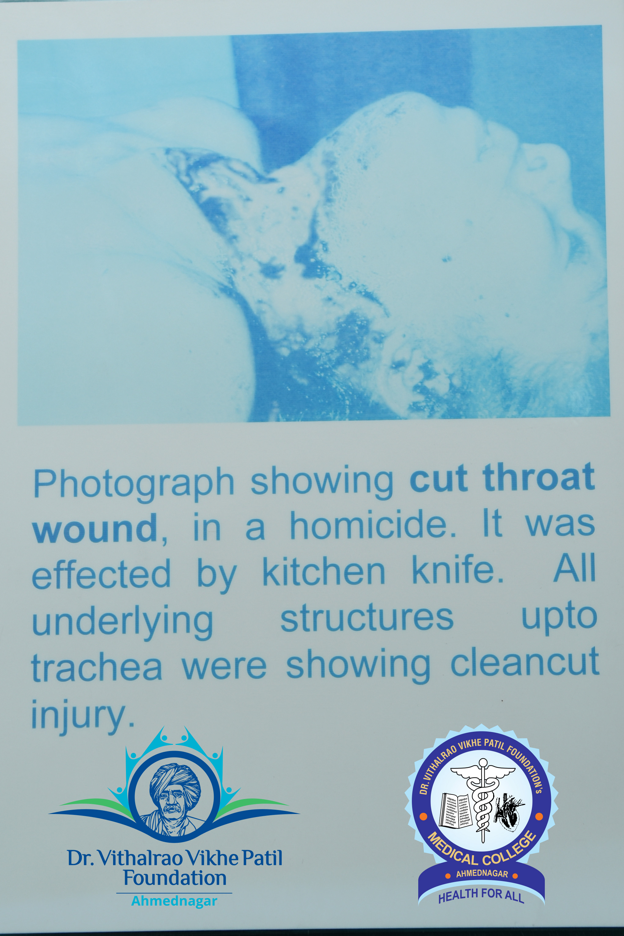 Popup Image