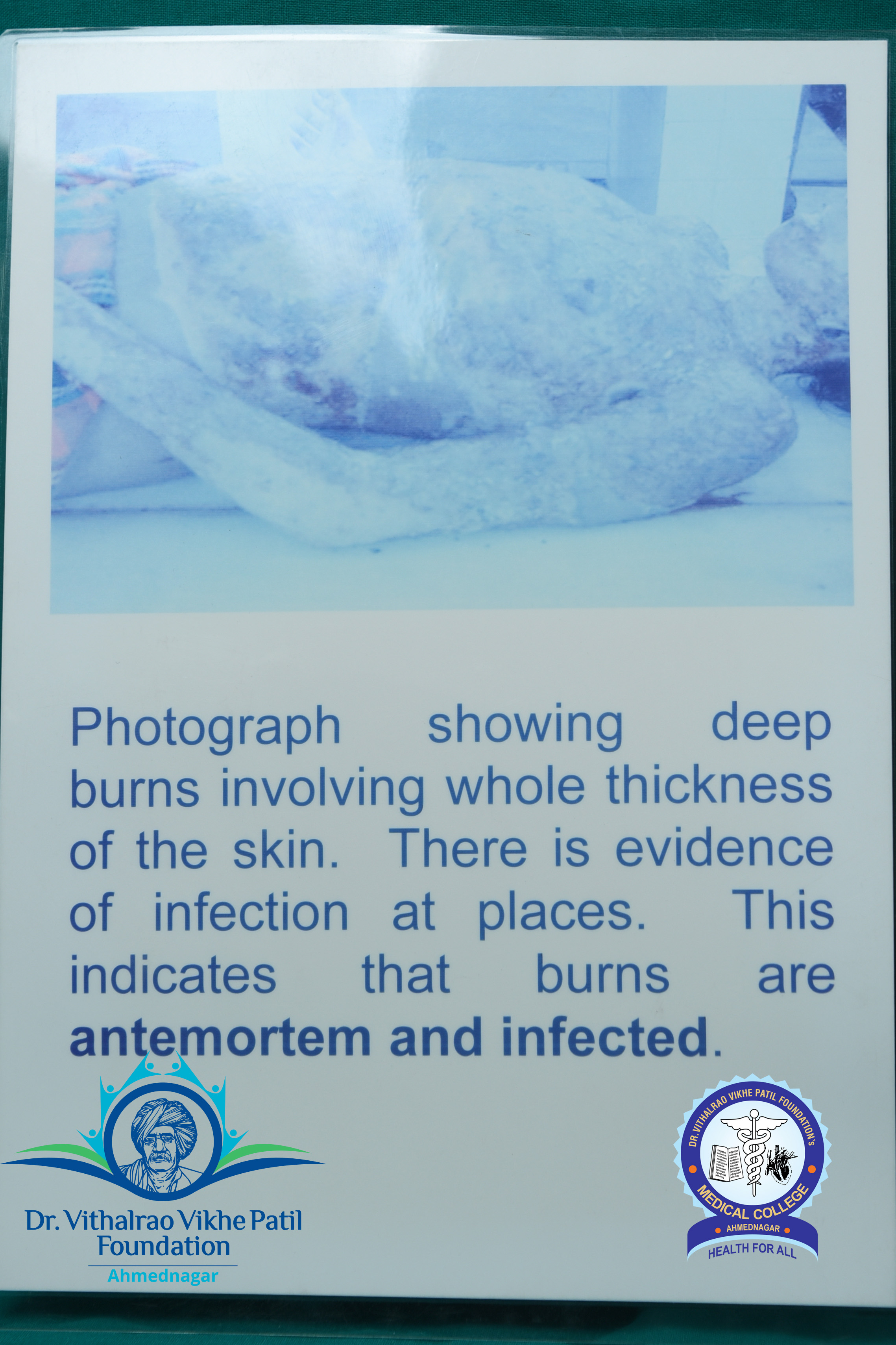 Popup Image