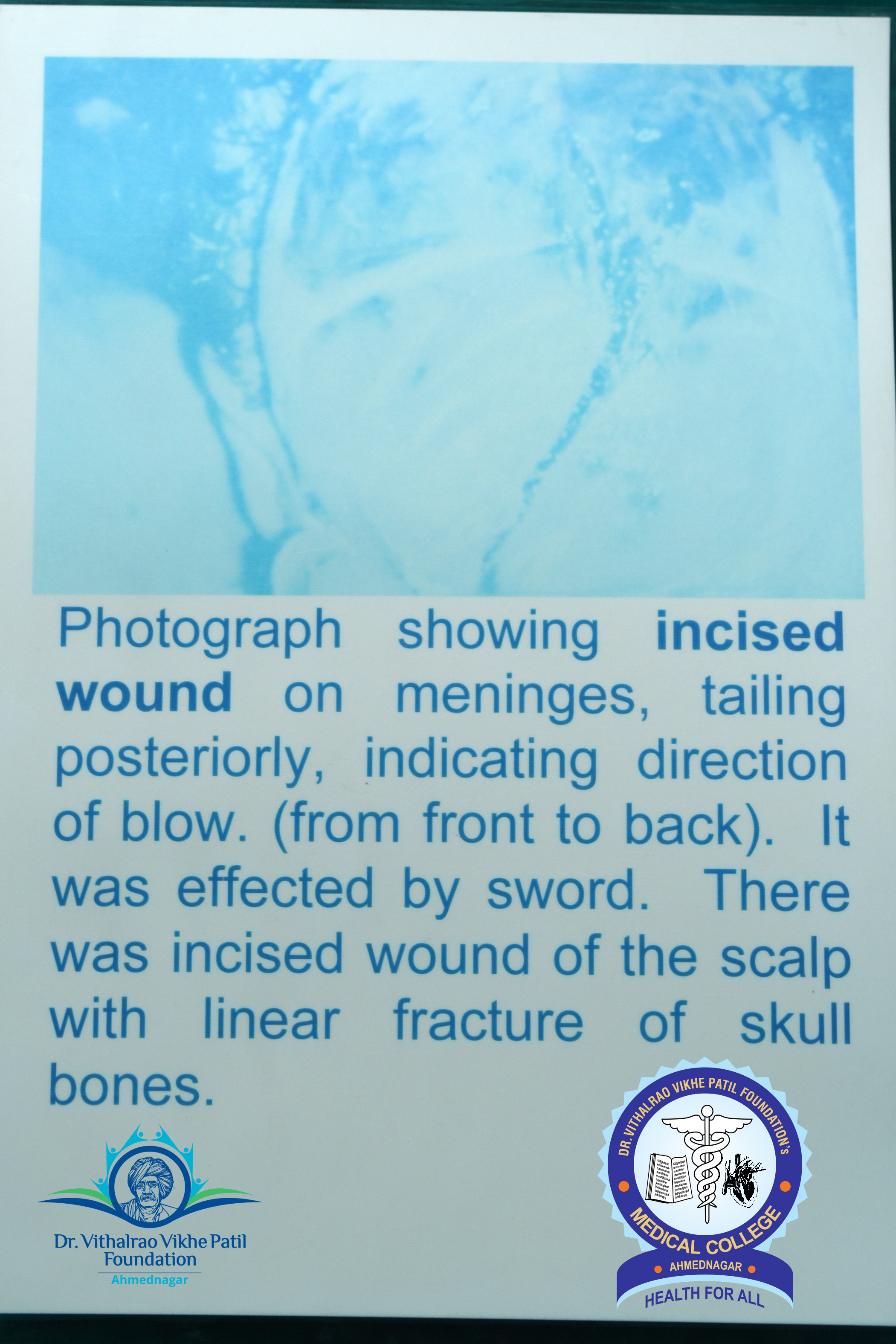 Popup Image