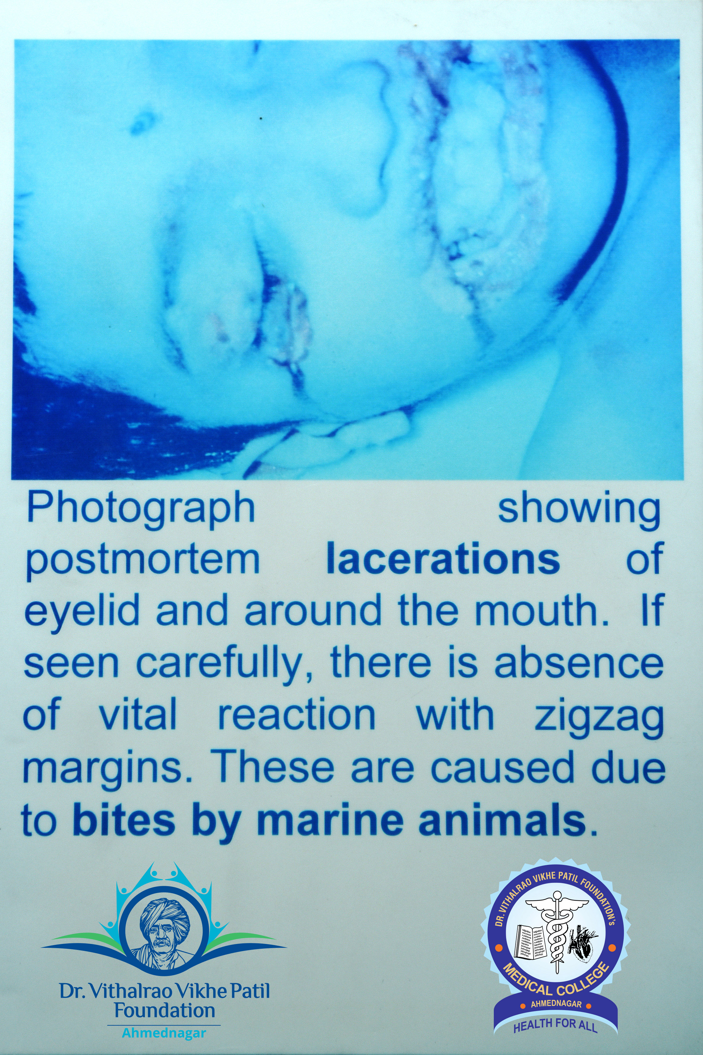 Popup Image
