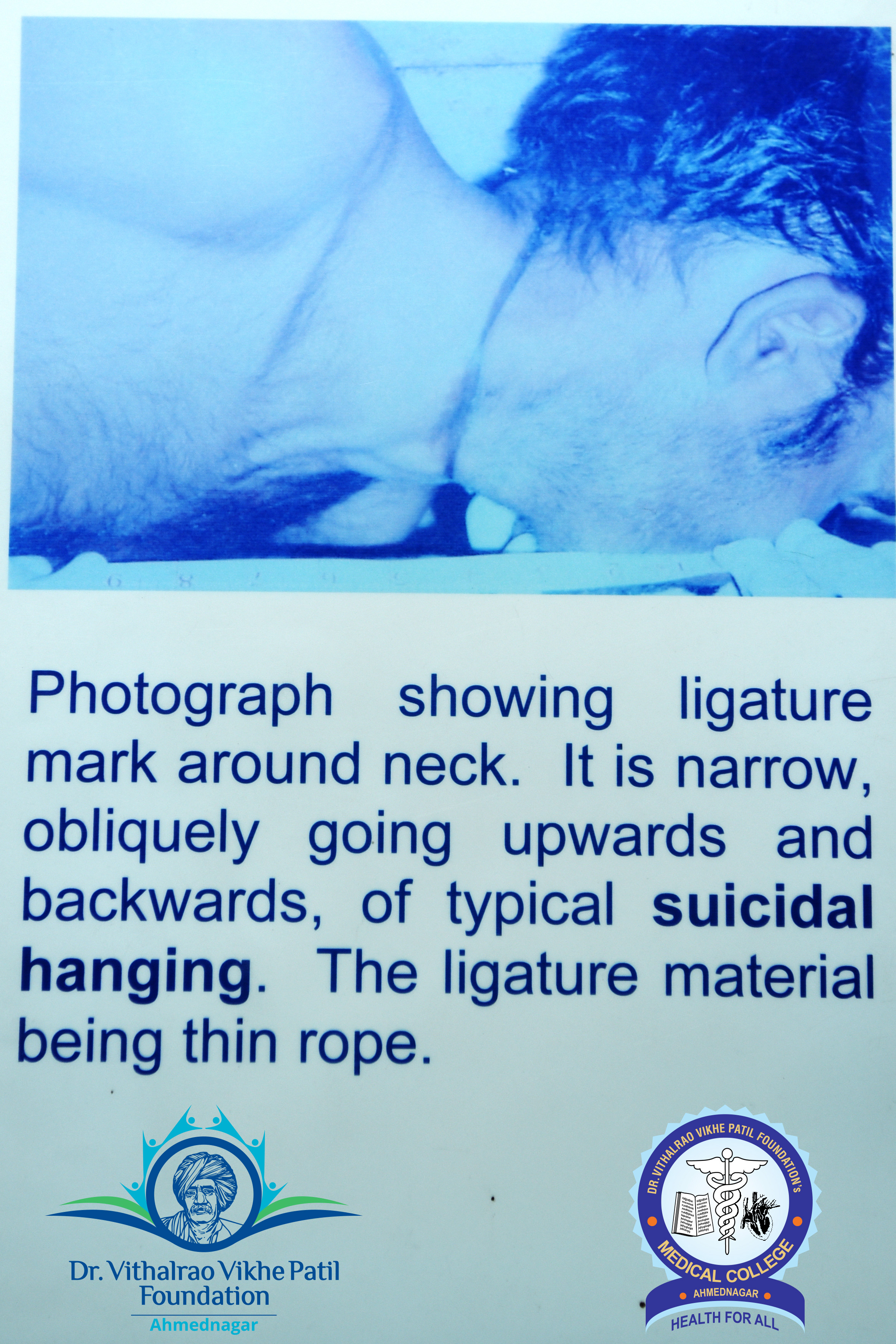 Popup Image