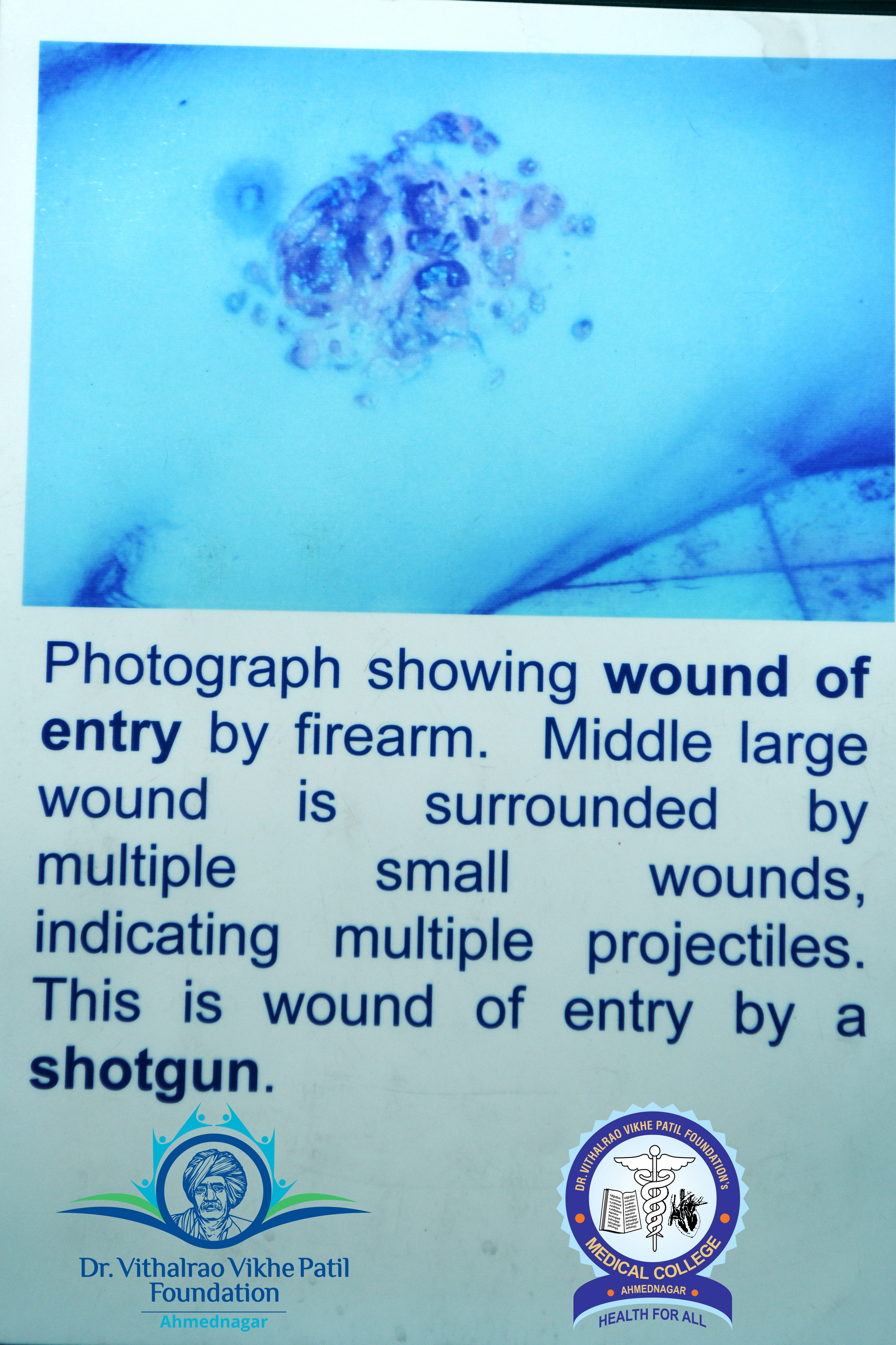 Popup Image