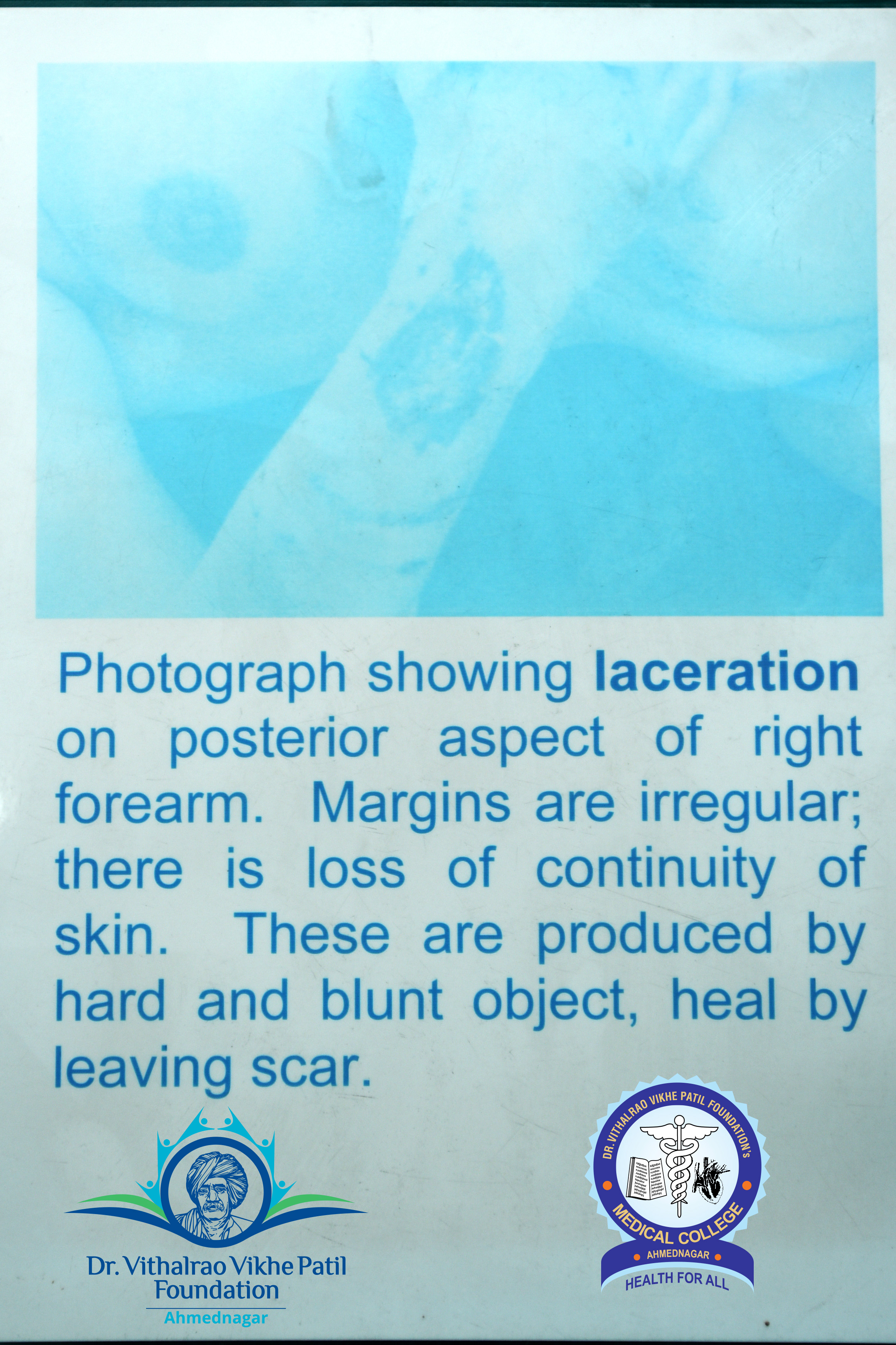 Popup Image