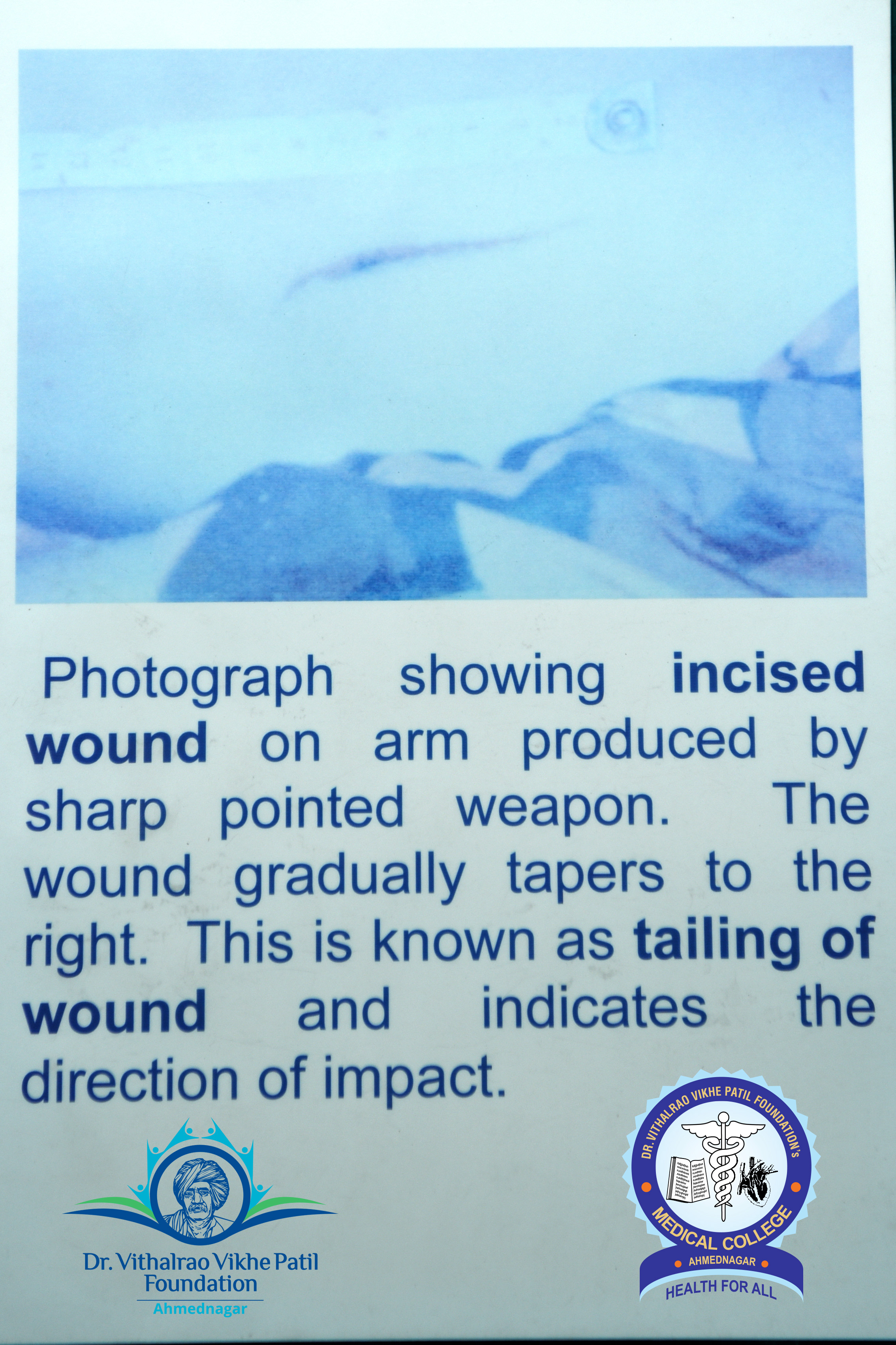 Popup Image