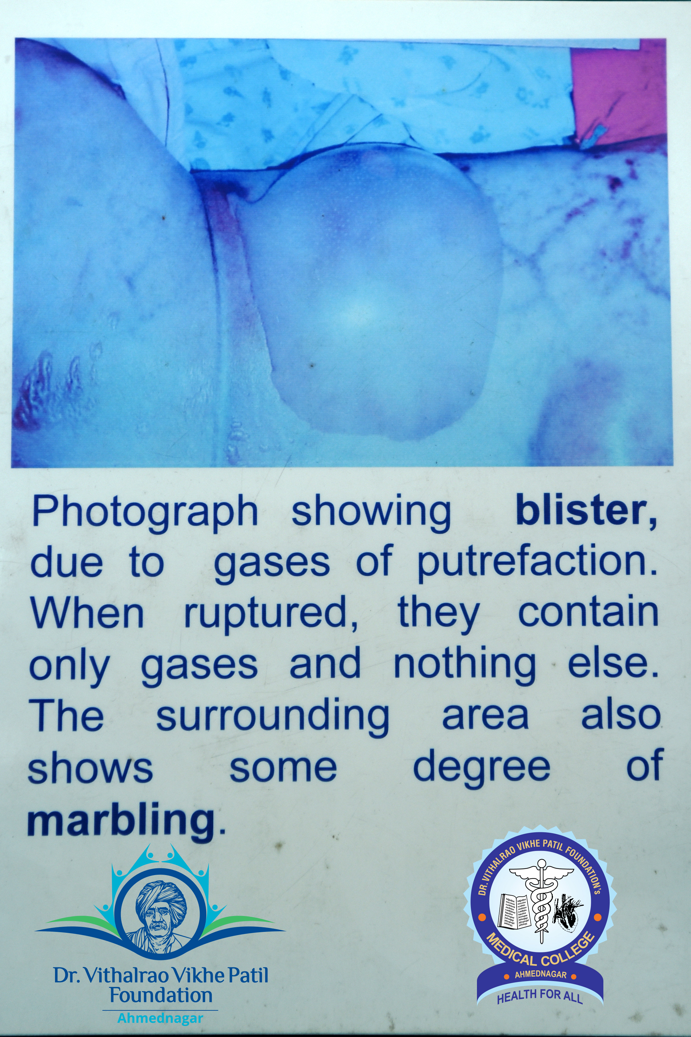 Popup Image