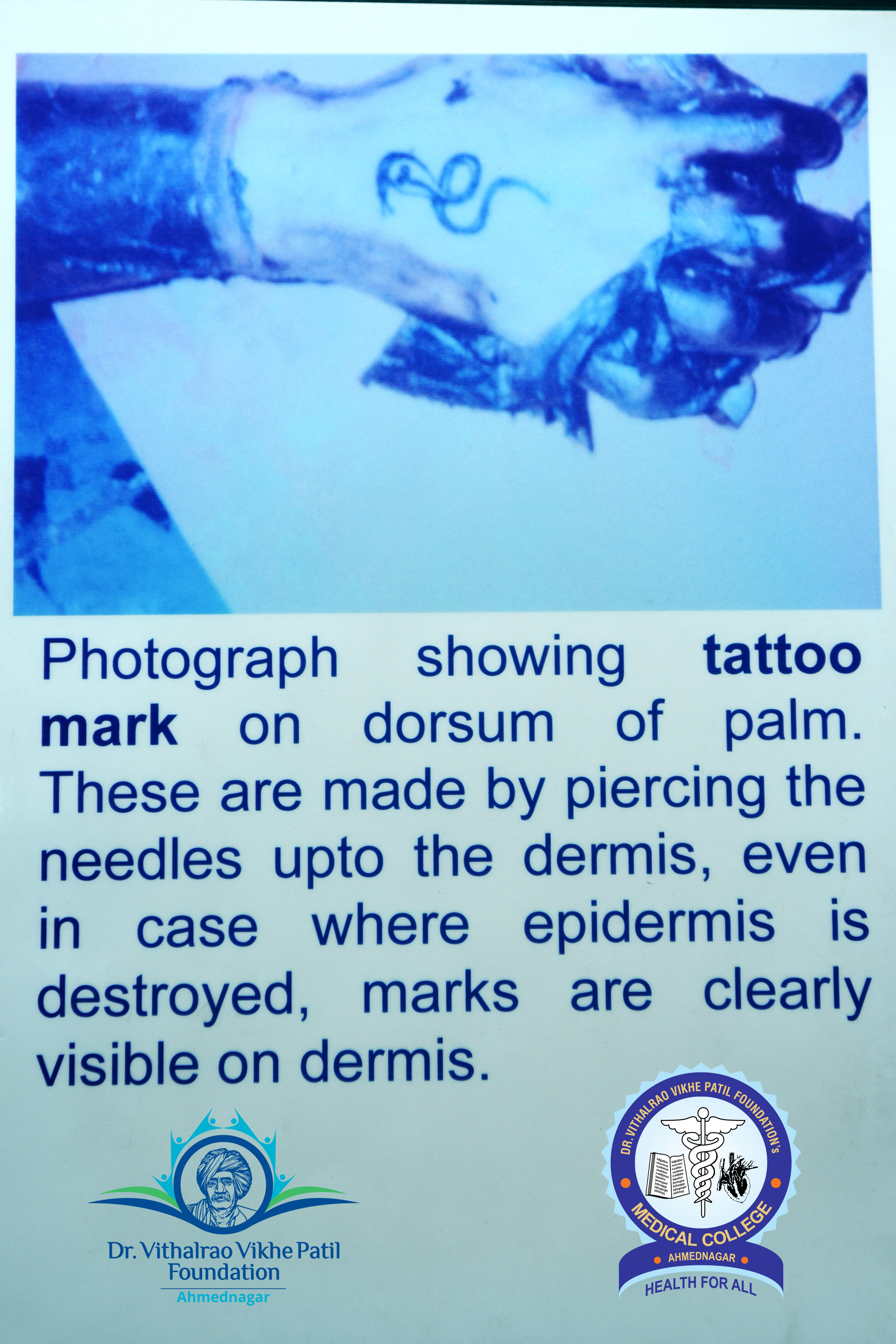 Popup Image