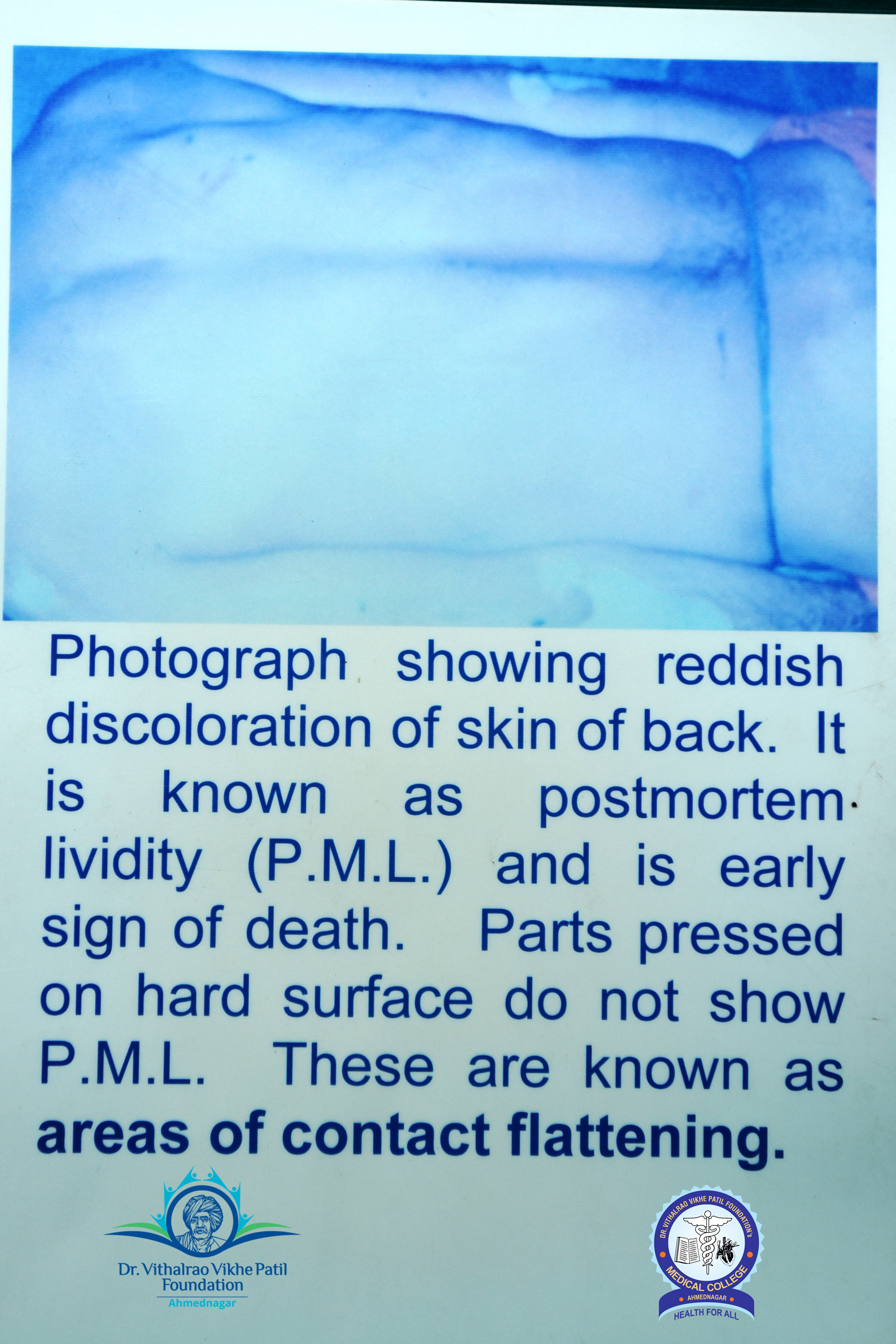 Popup Image