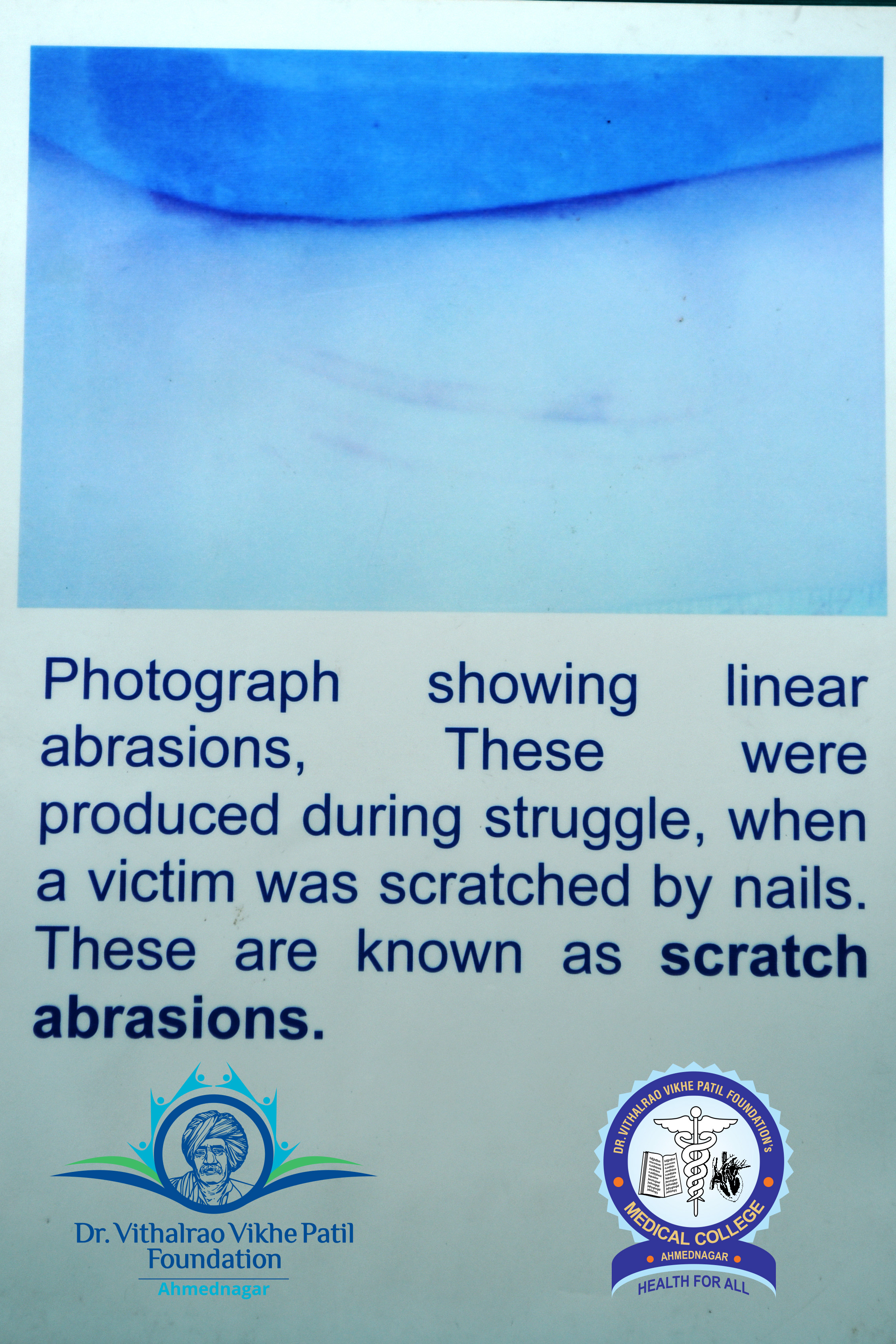 Popup Image