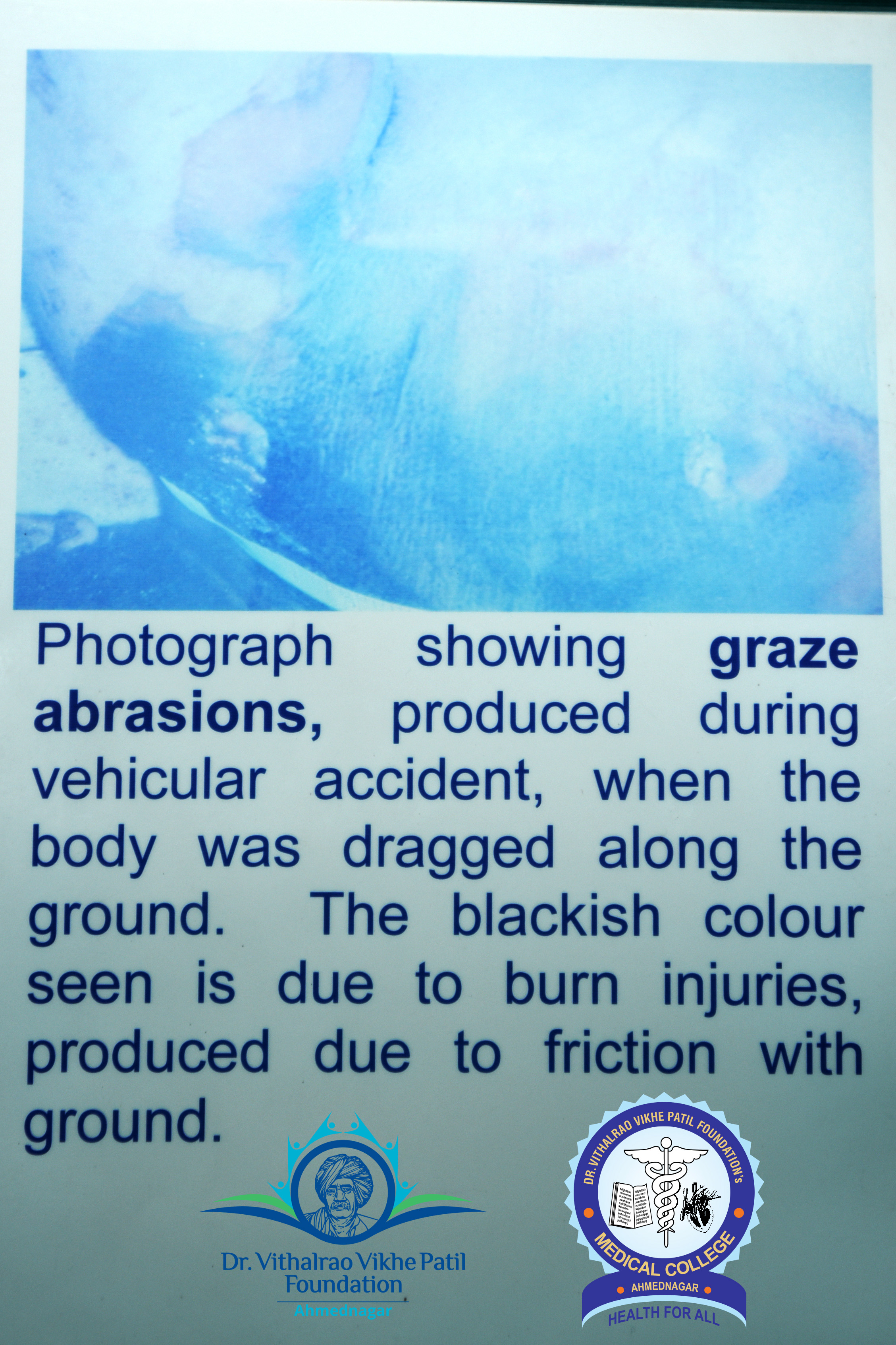 Popup Image