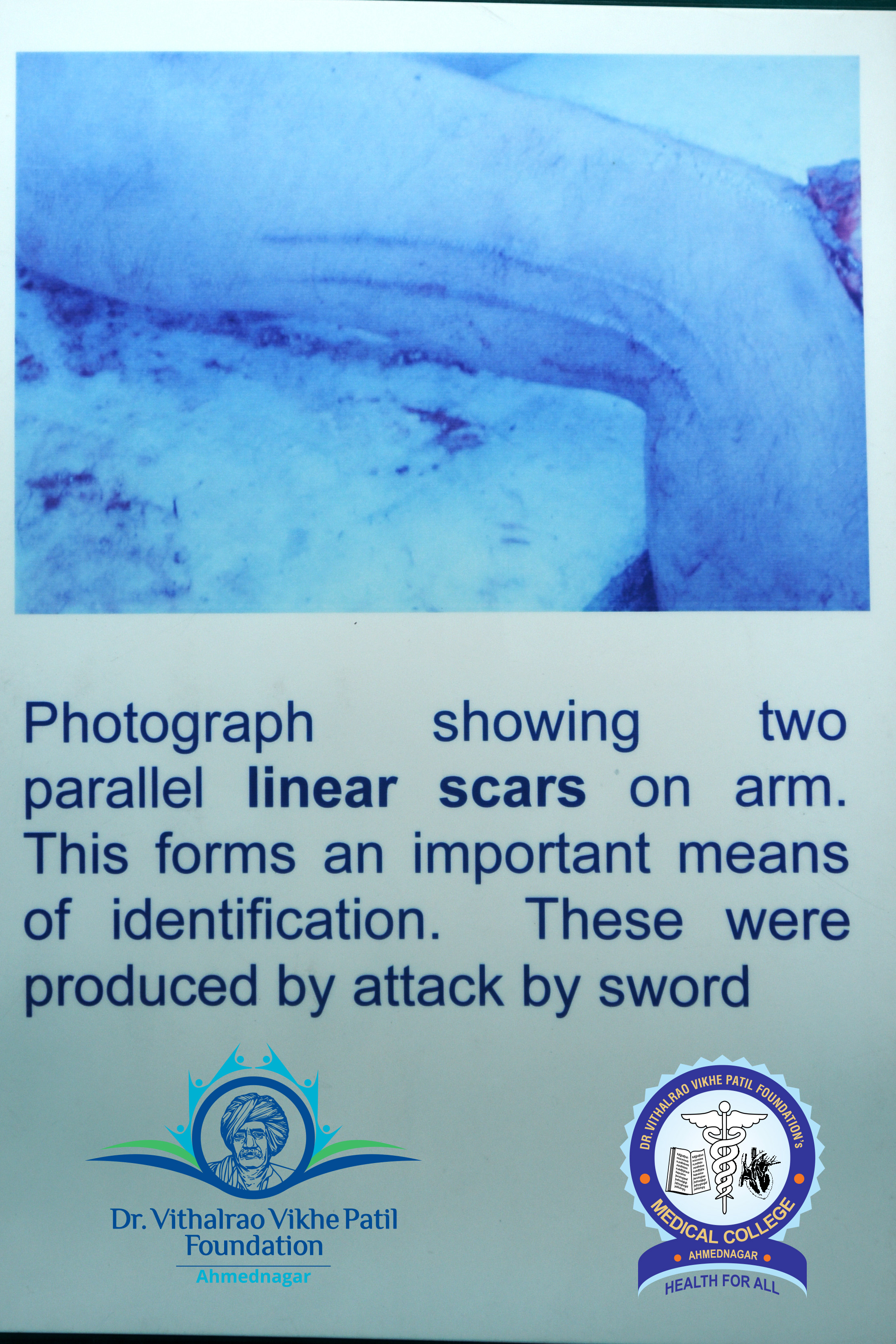 Popup Image