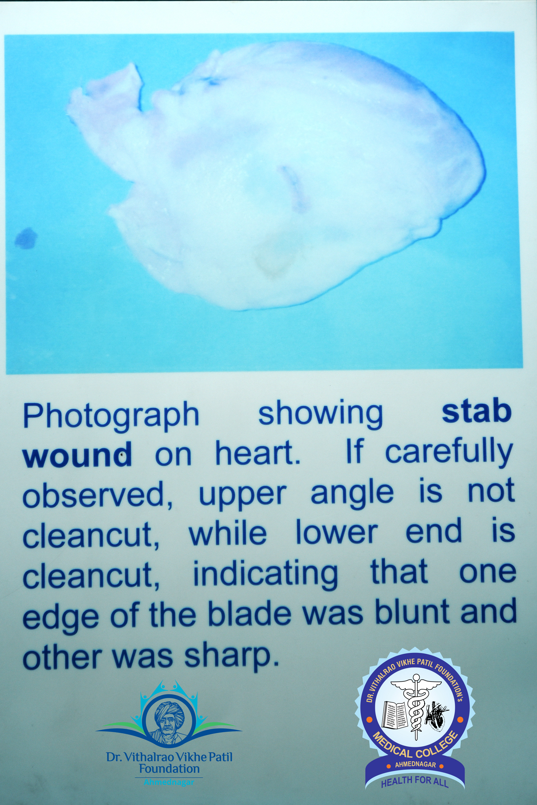 Popup Image