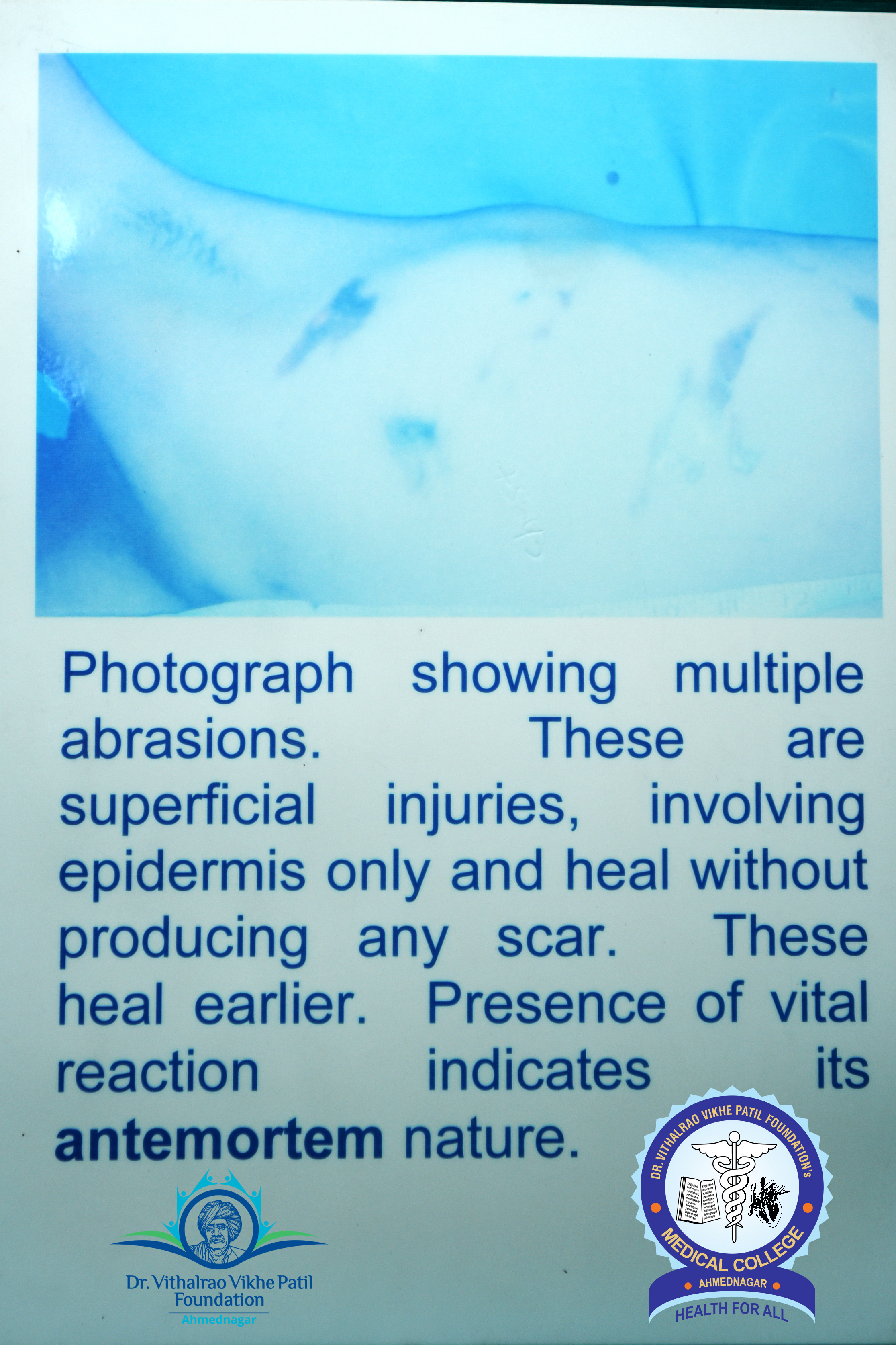 Popup Image