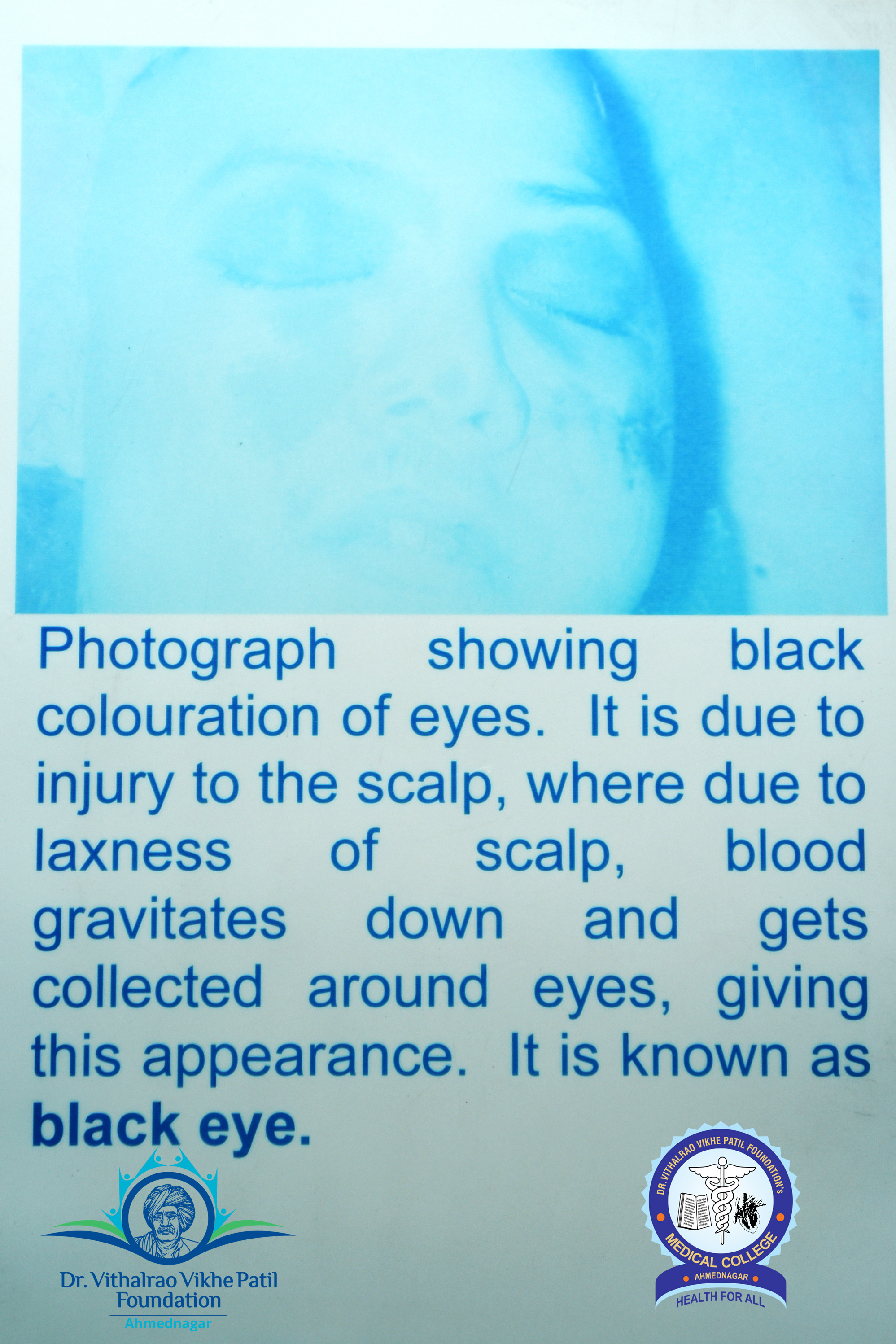 Popup Image