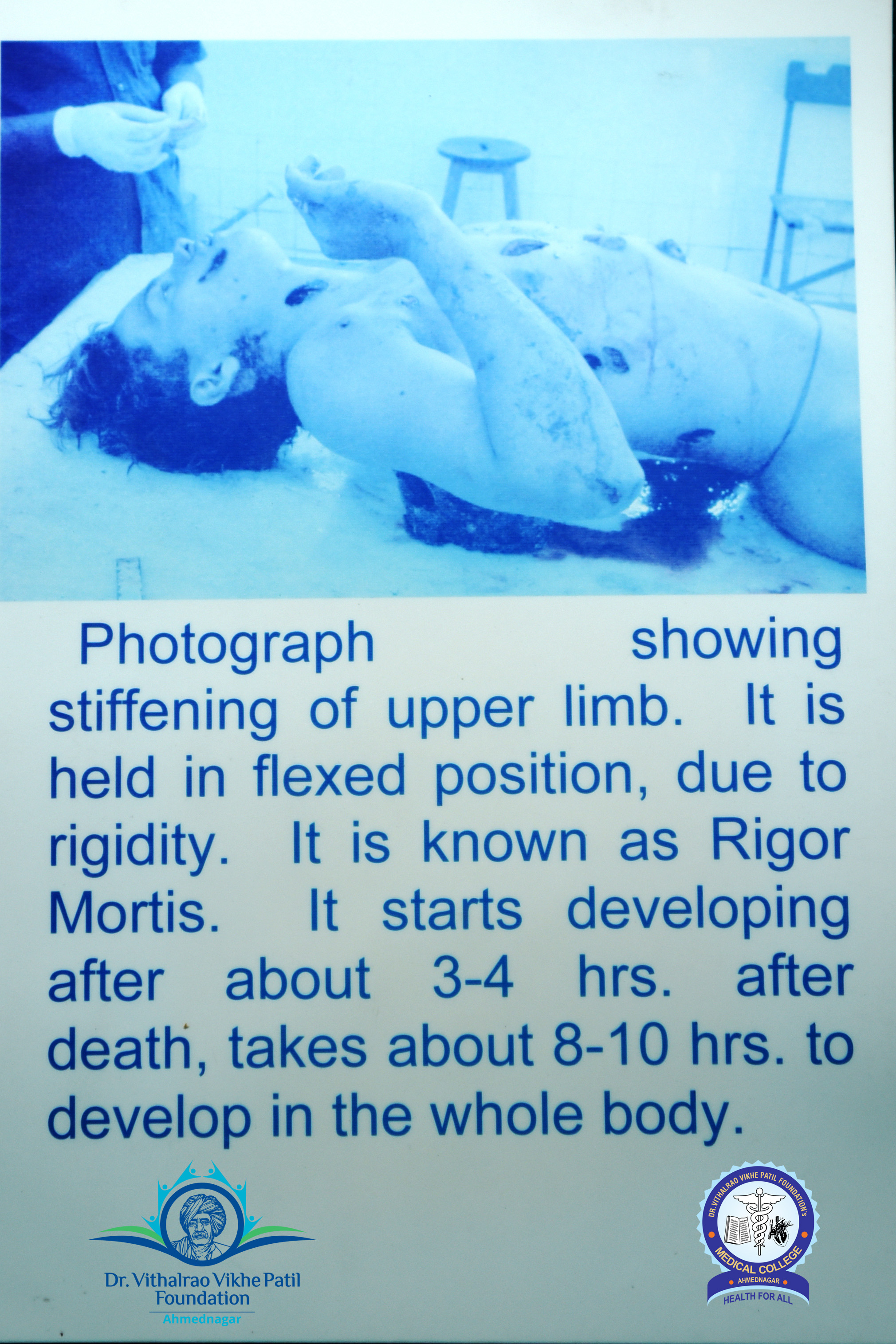 Popup Image