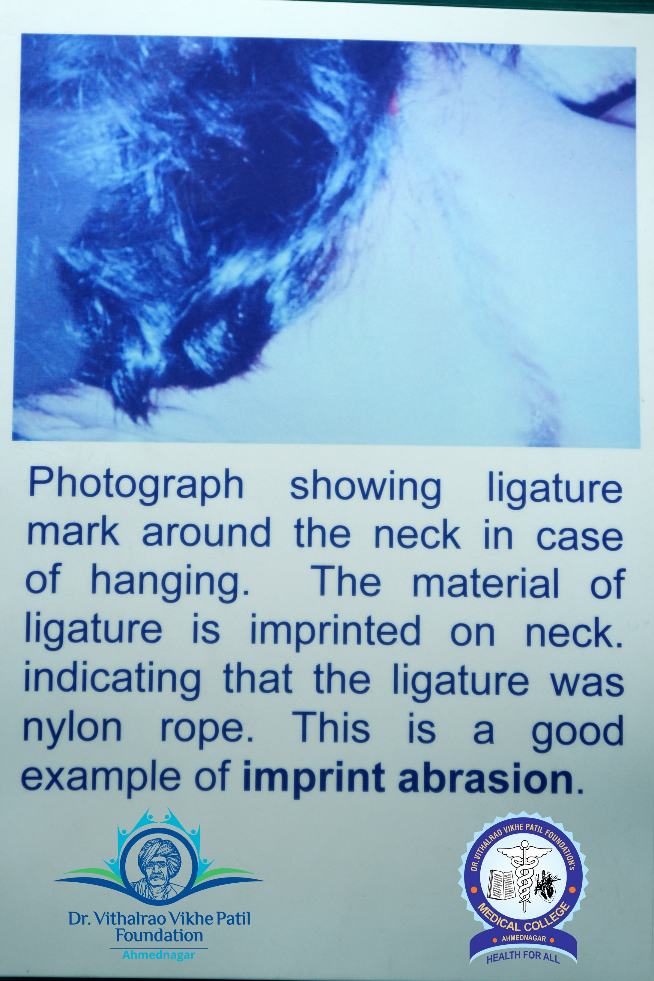 Popup Image