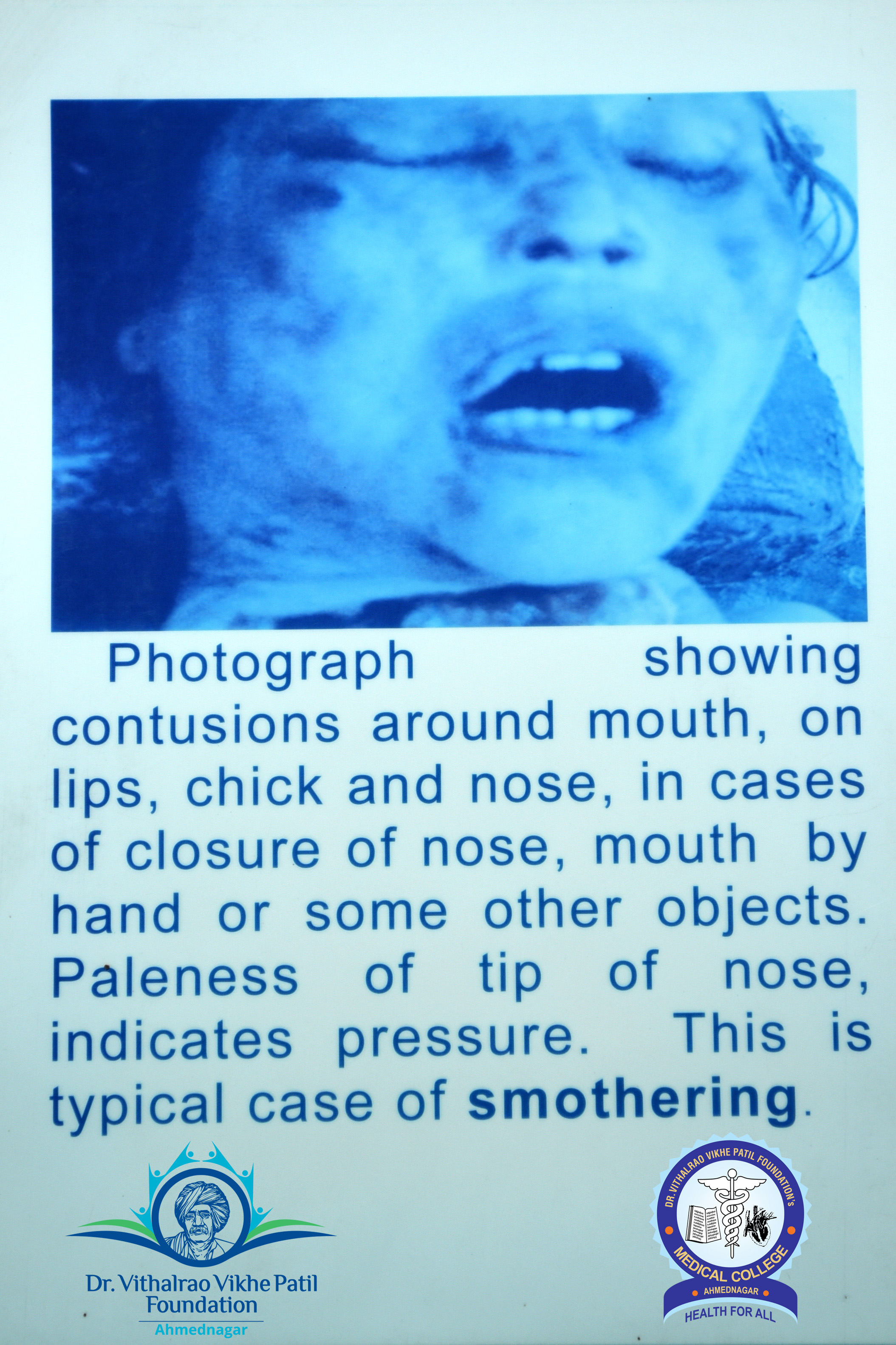 Popup Image