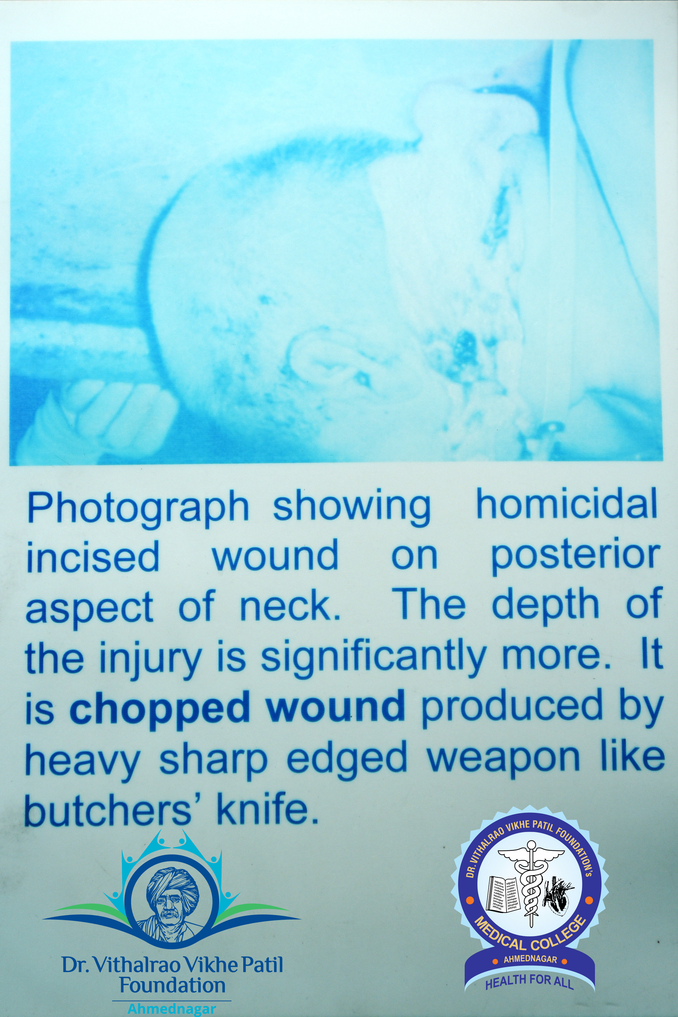 Popup Image