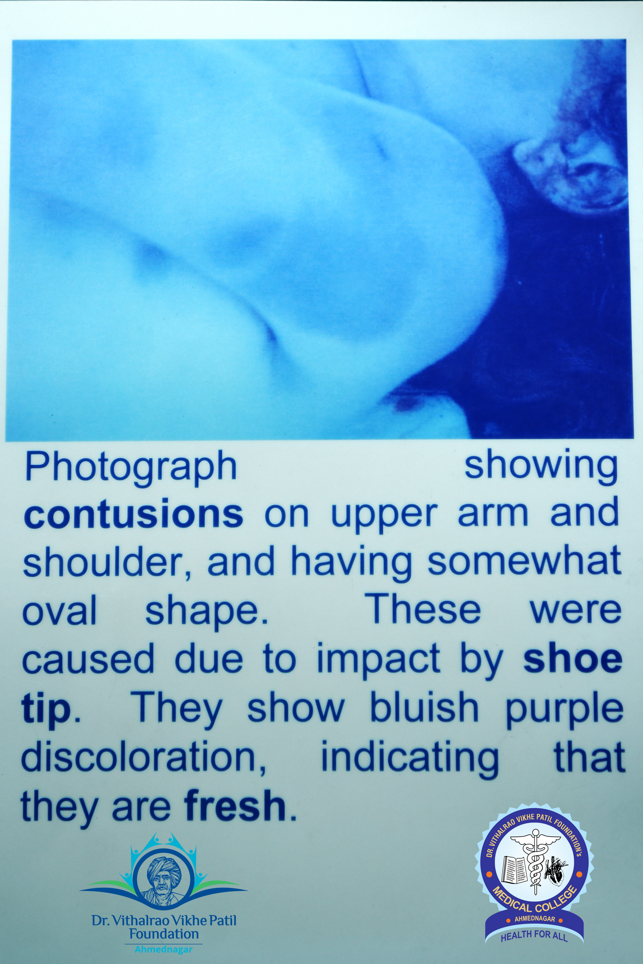 Popup Image