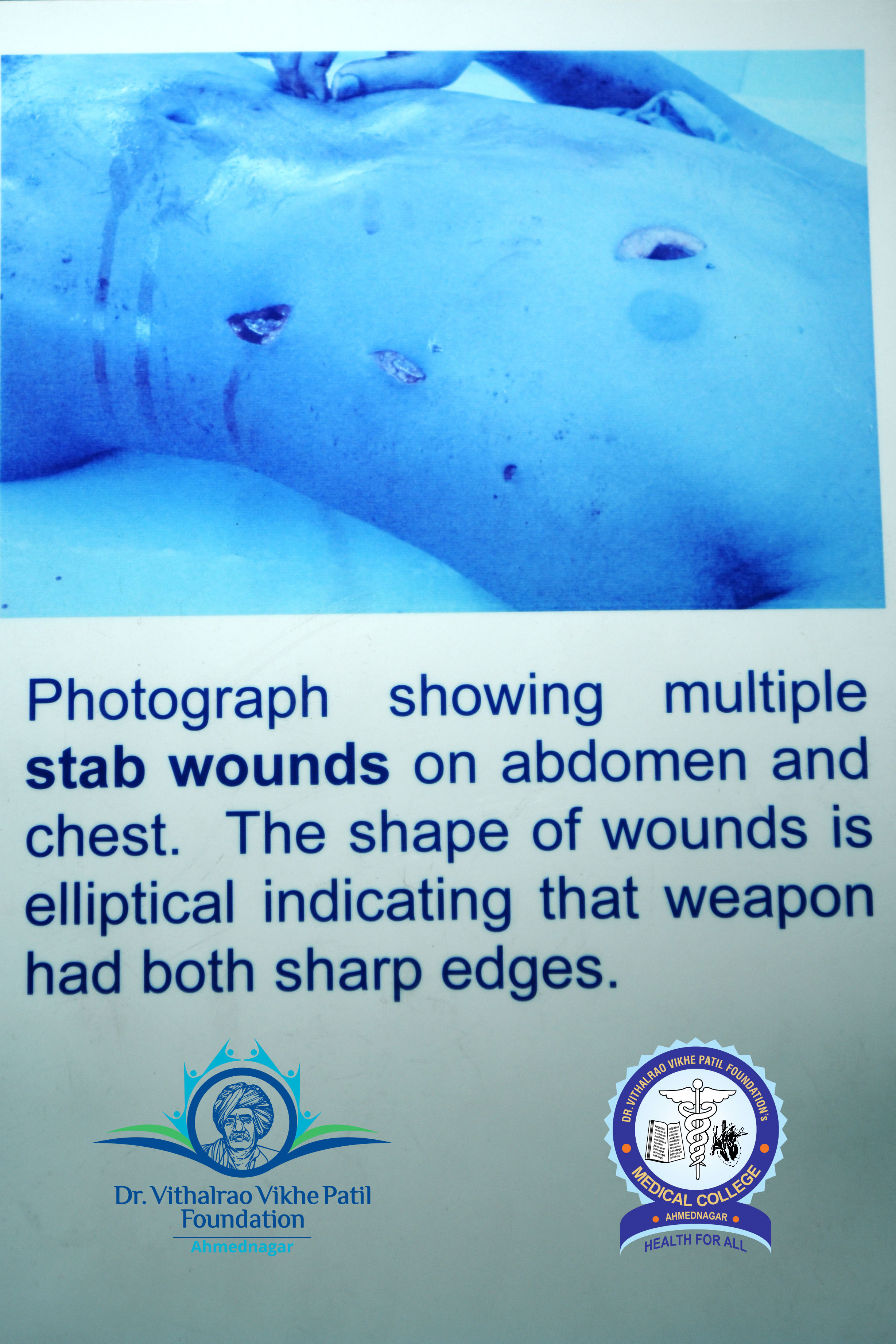 Popup Image