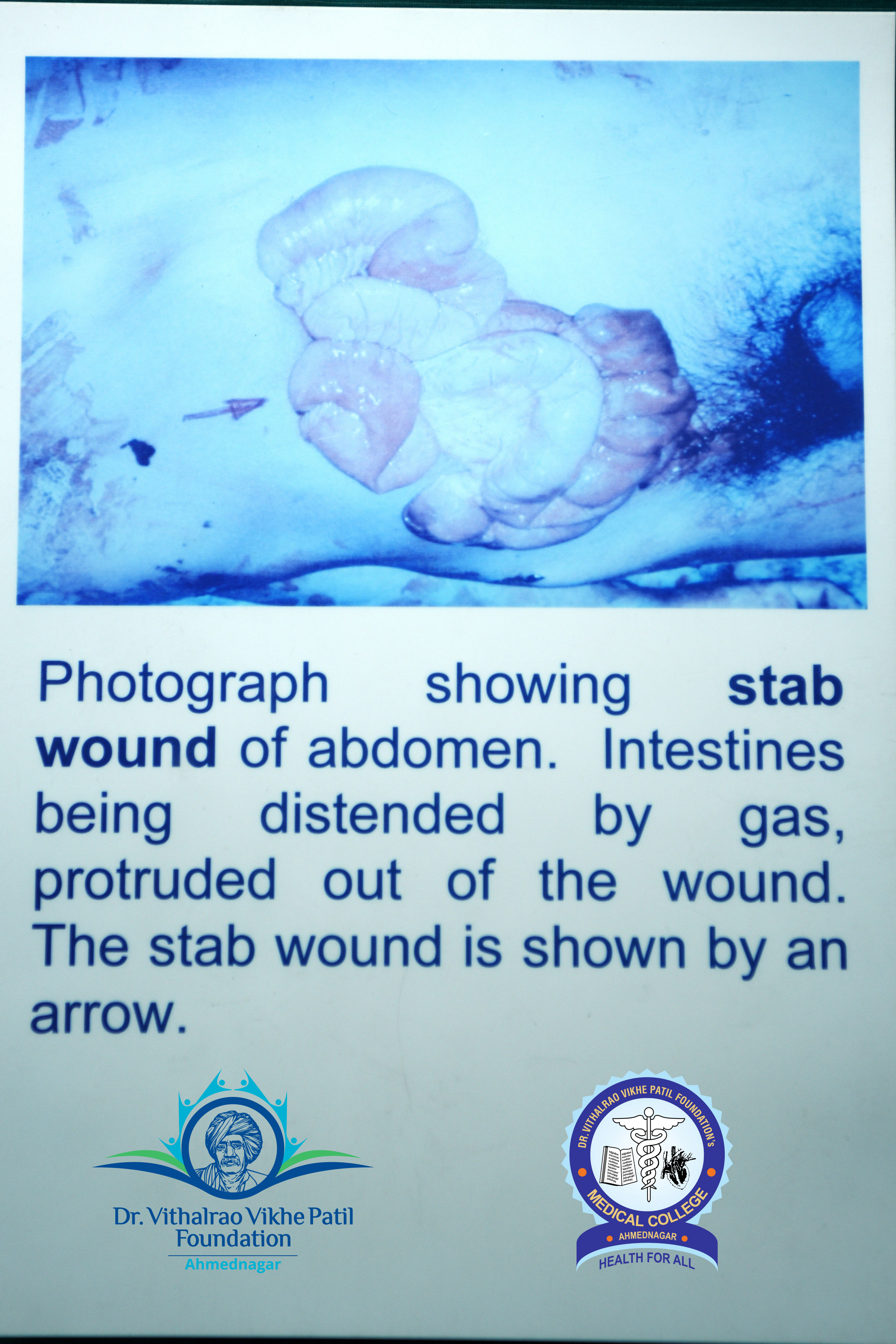 Popup Image