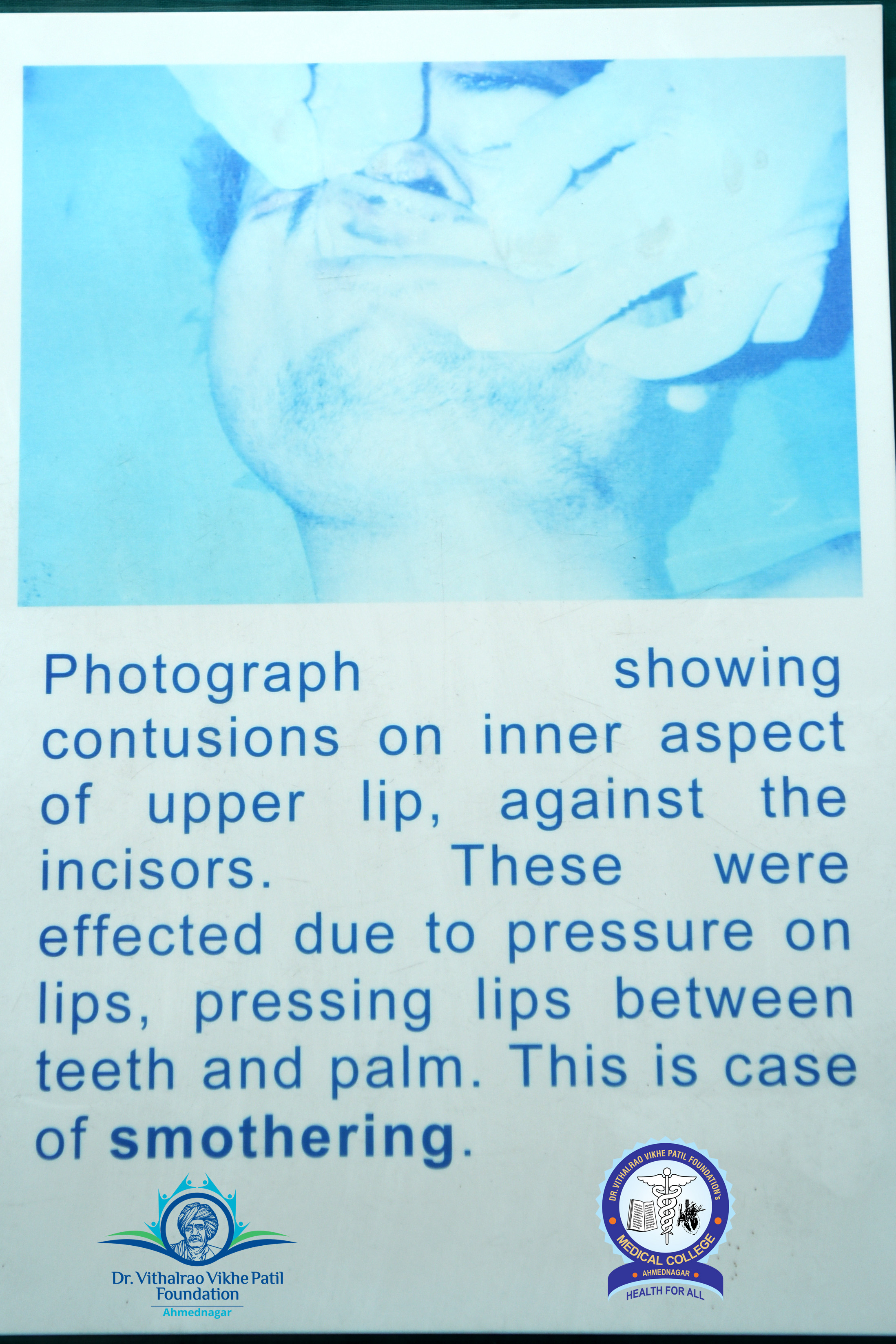 Popup Image