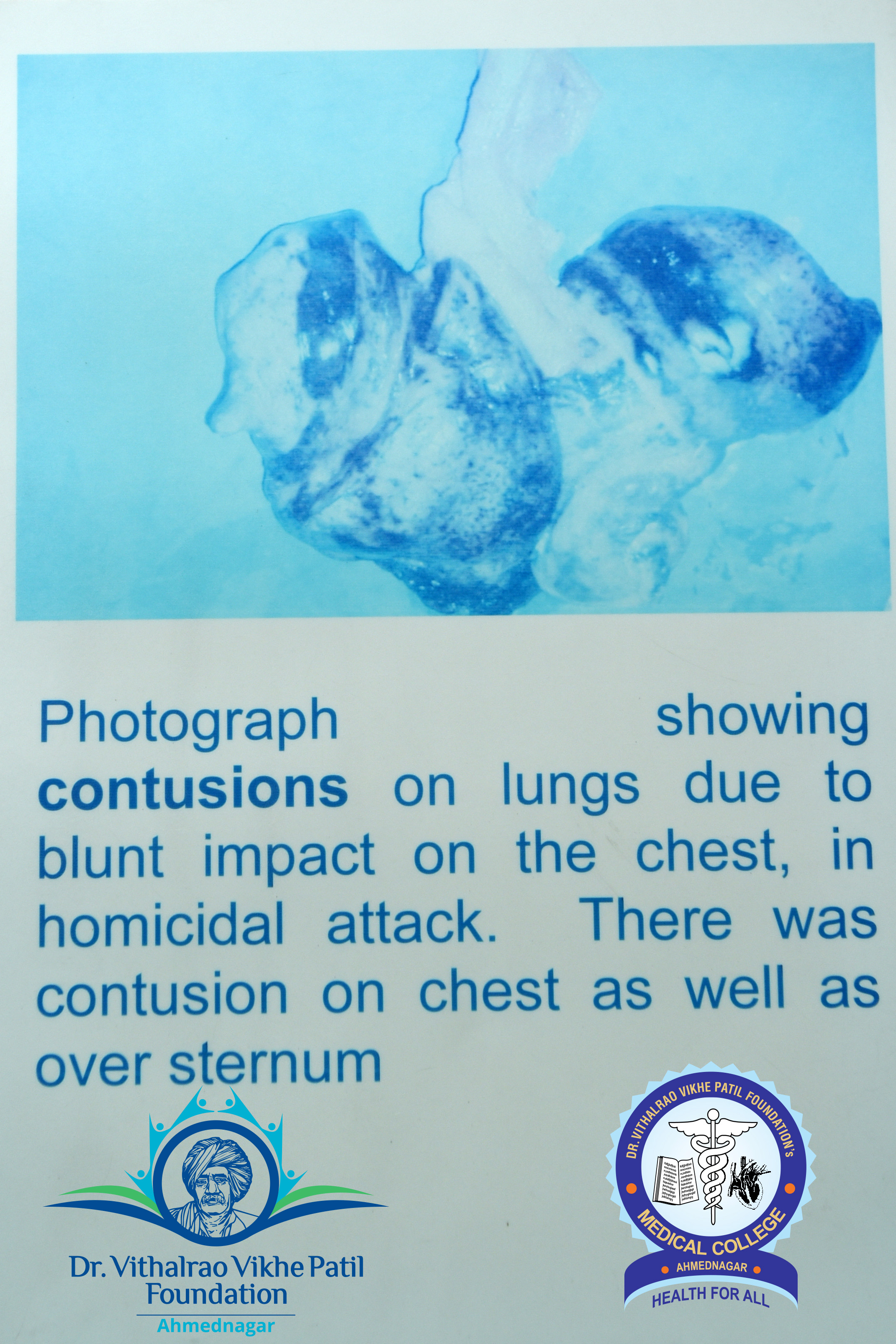 Popup Image