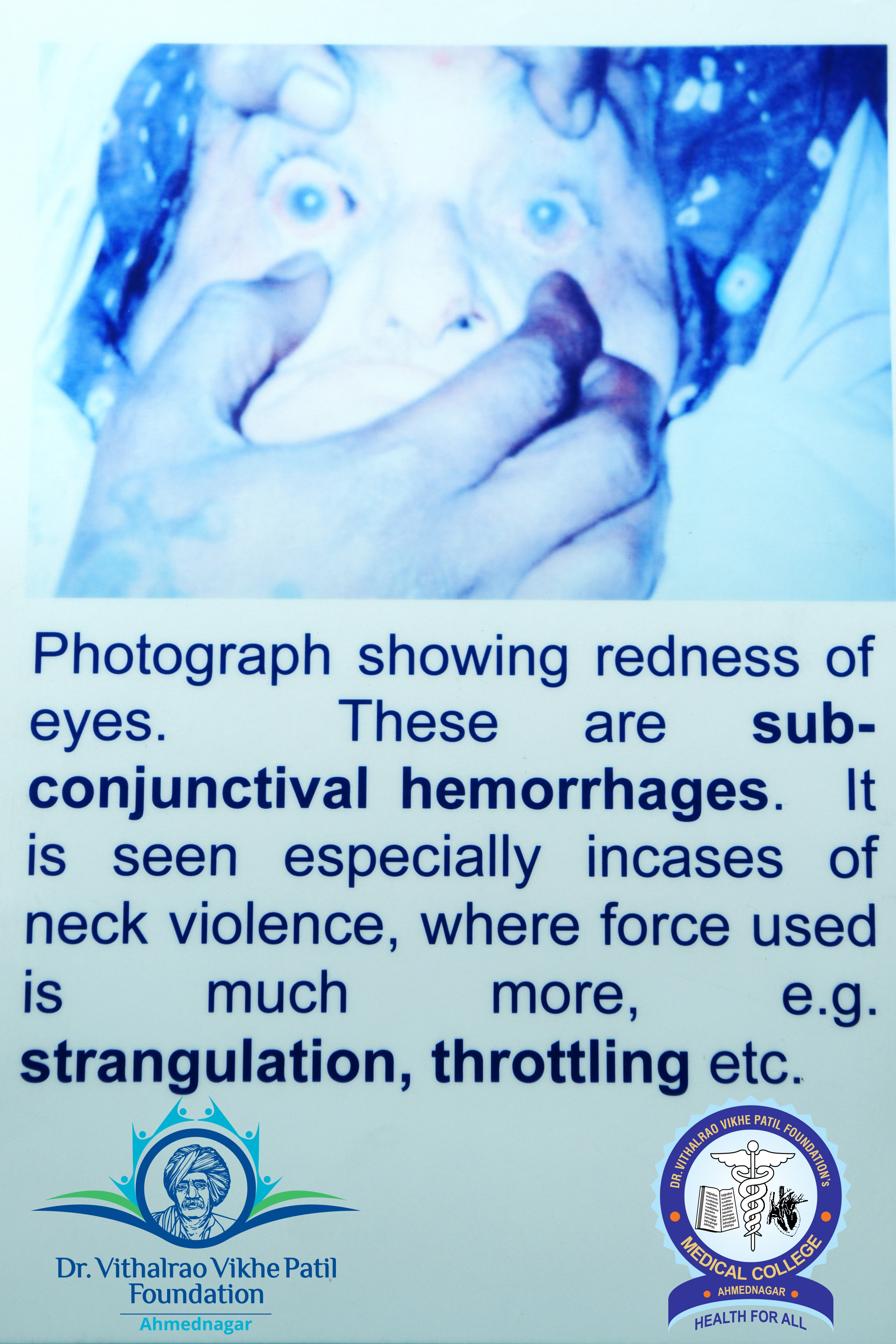Popup Image