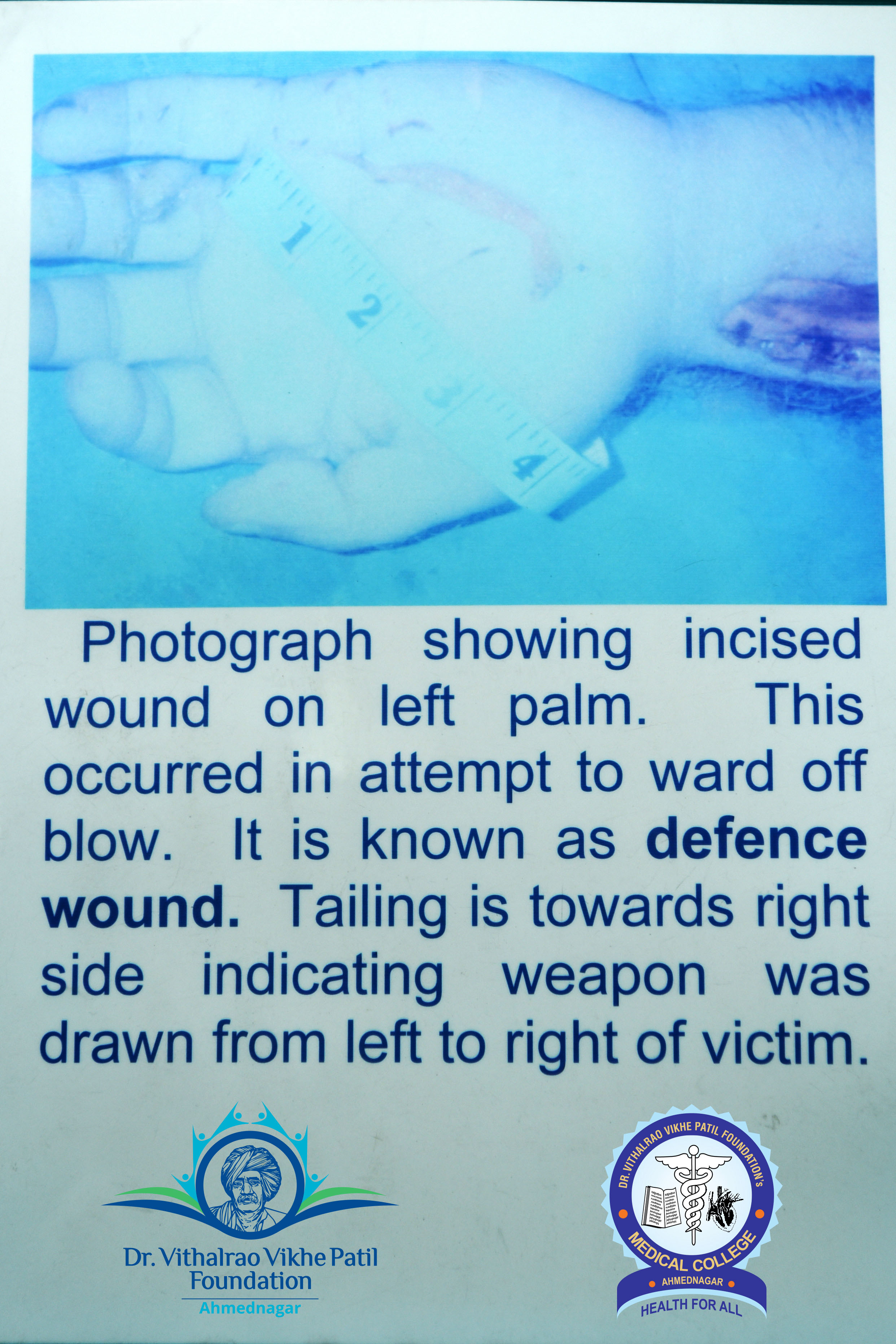 Popup Image