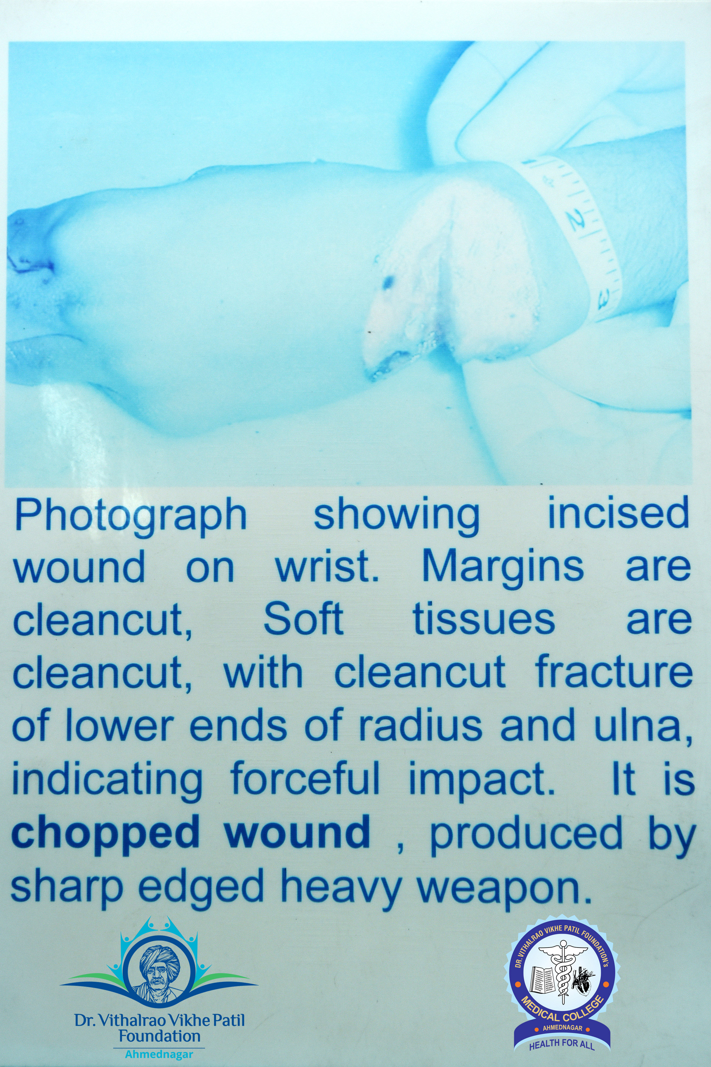 Popup Image