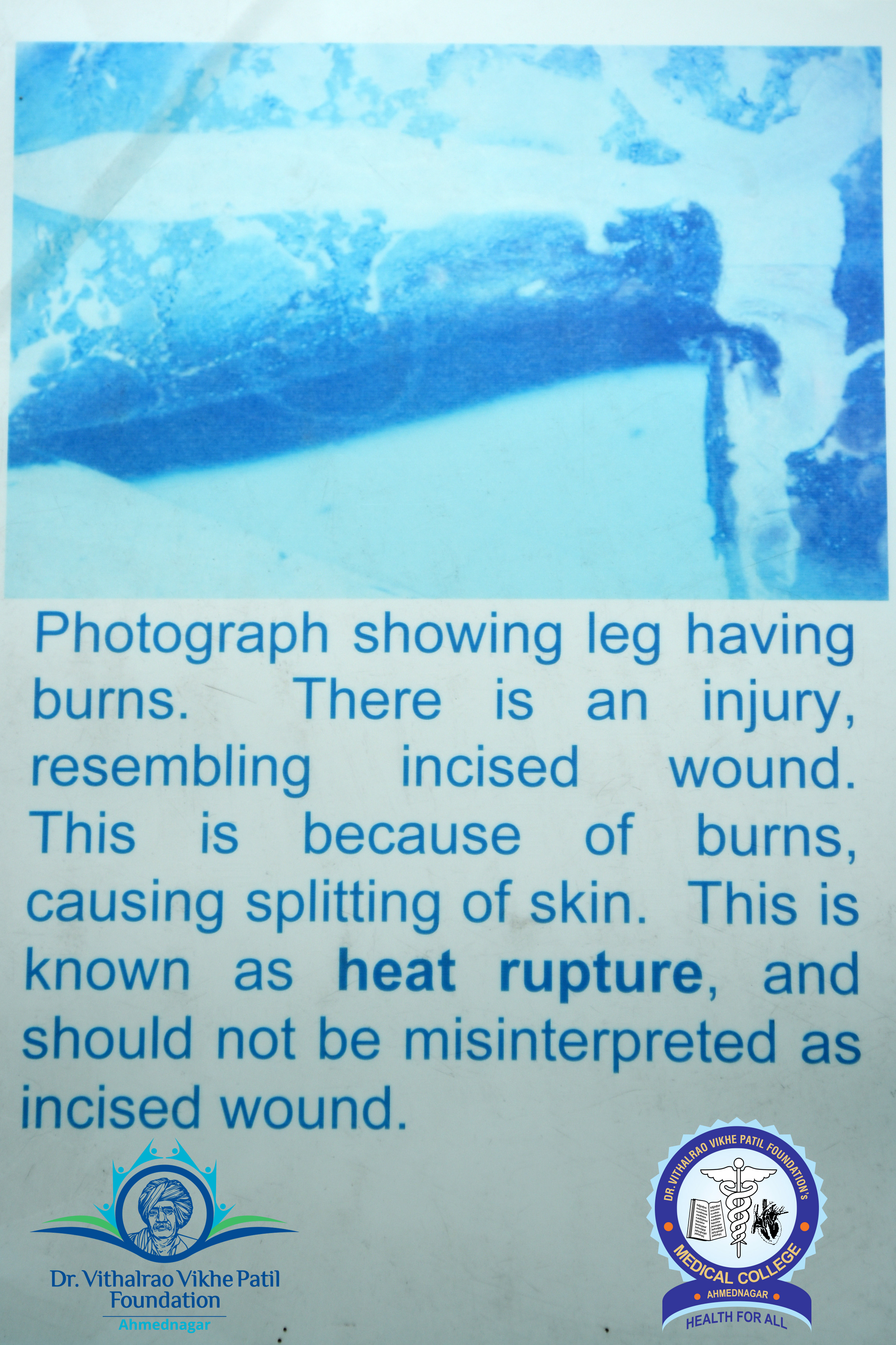 Popup Image