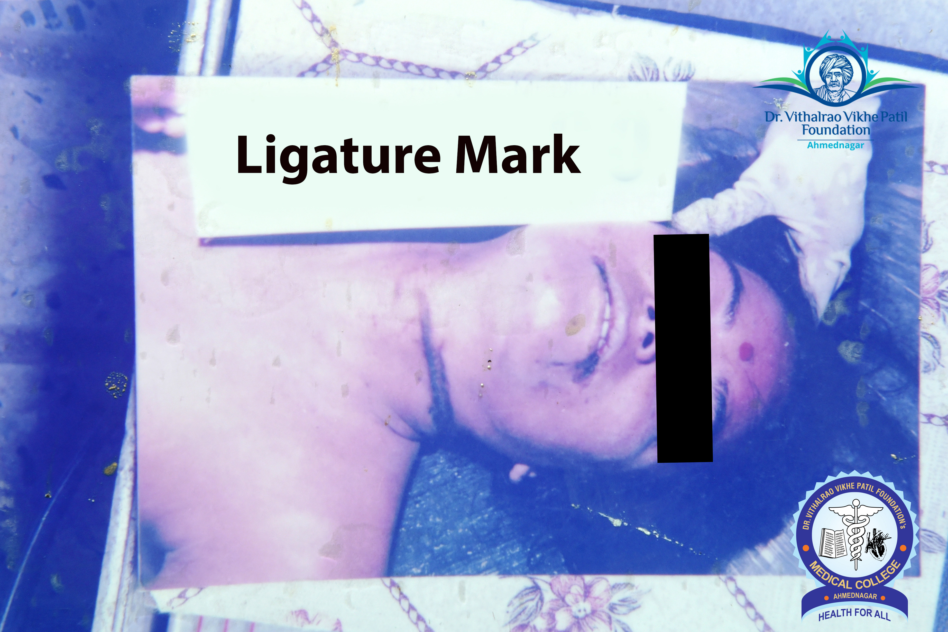 Popup Image