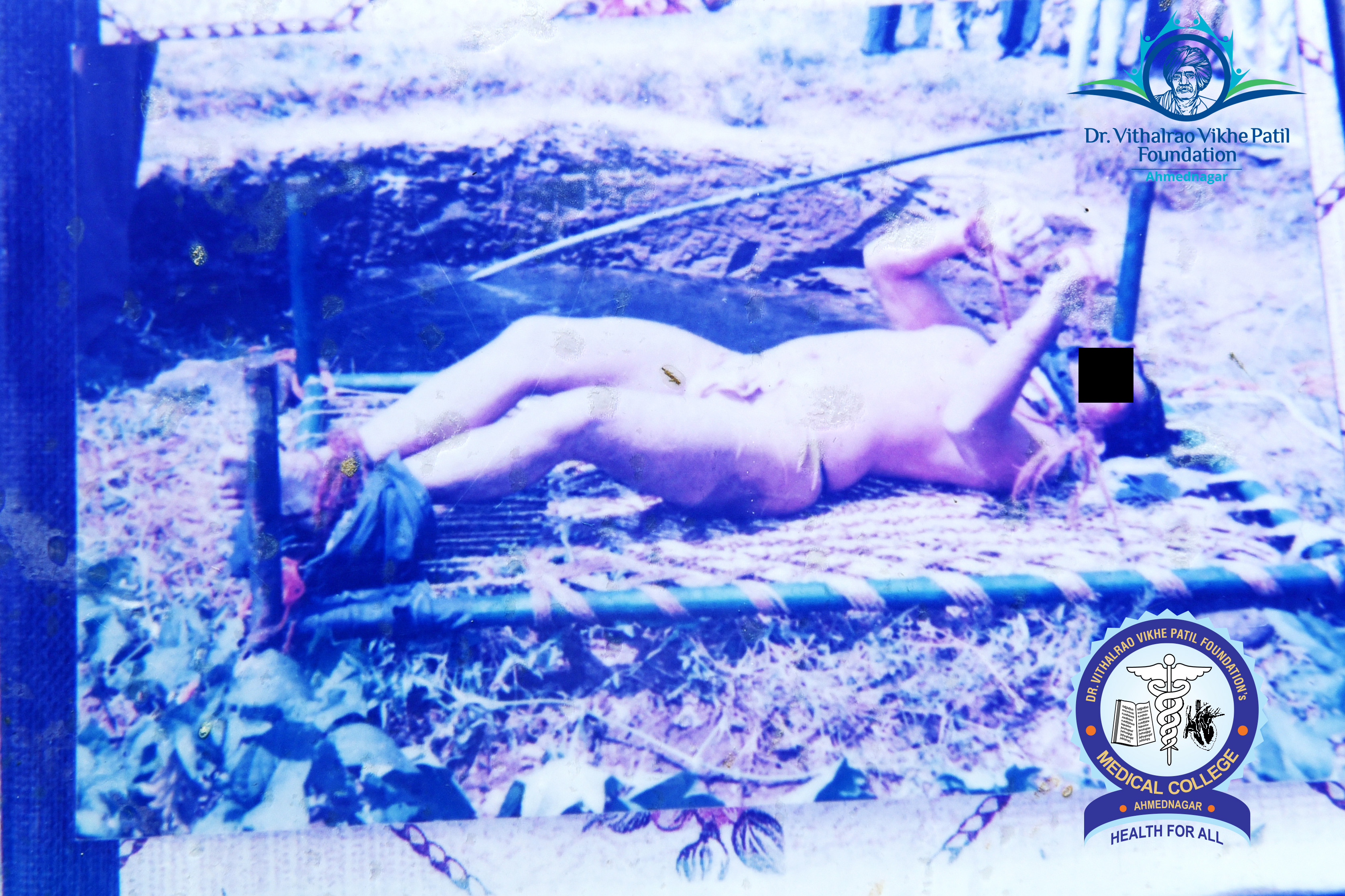 Popup Image