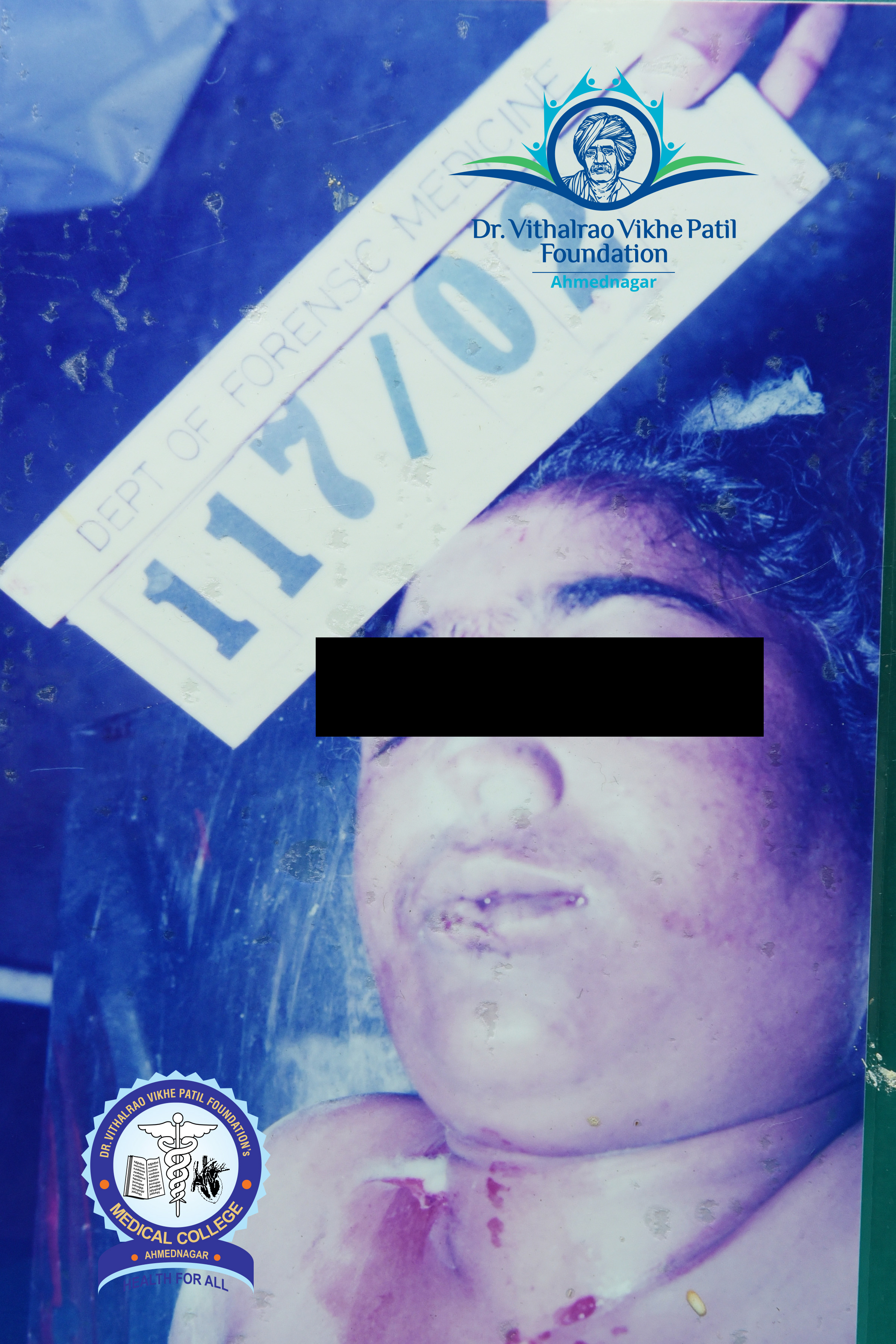 Popup Image