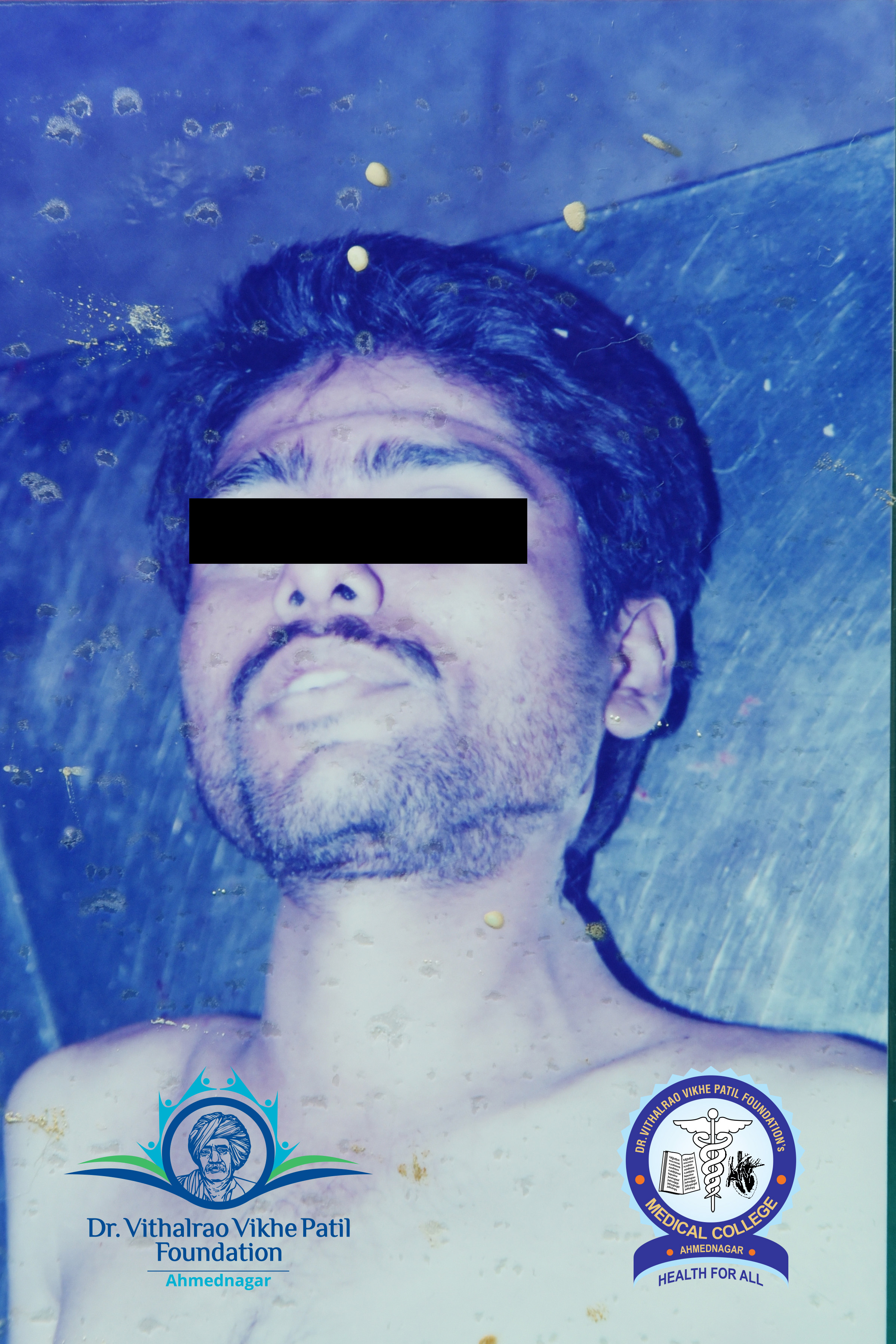 Popup Image